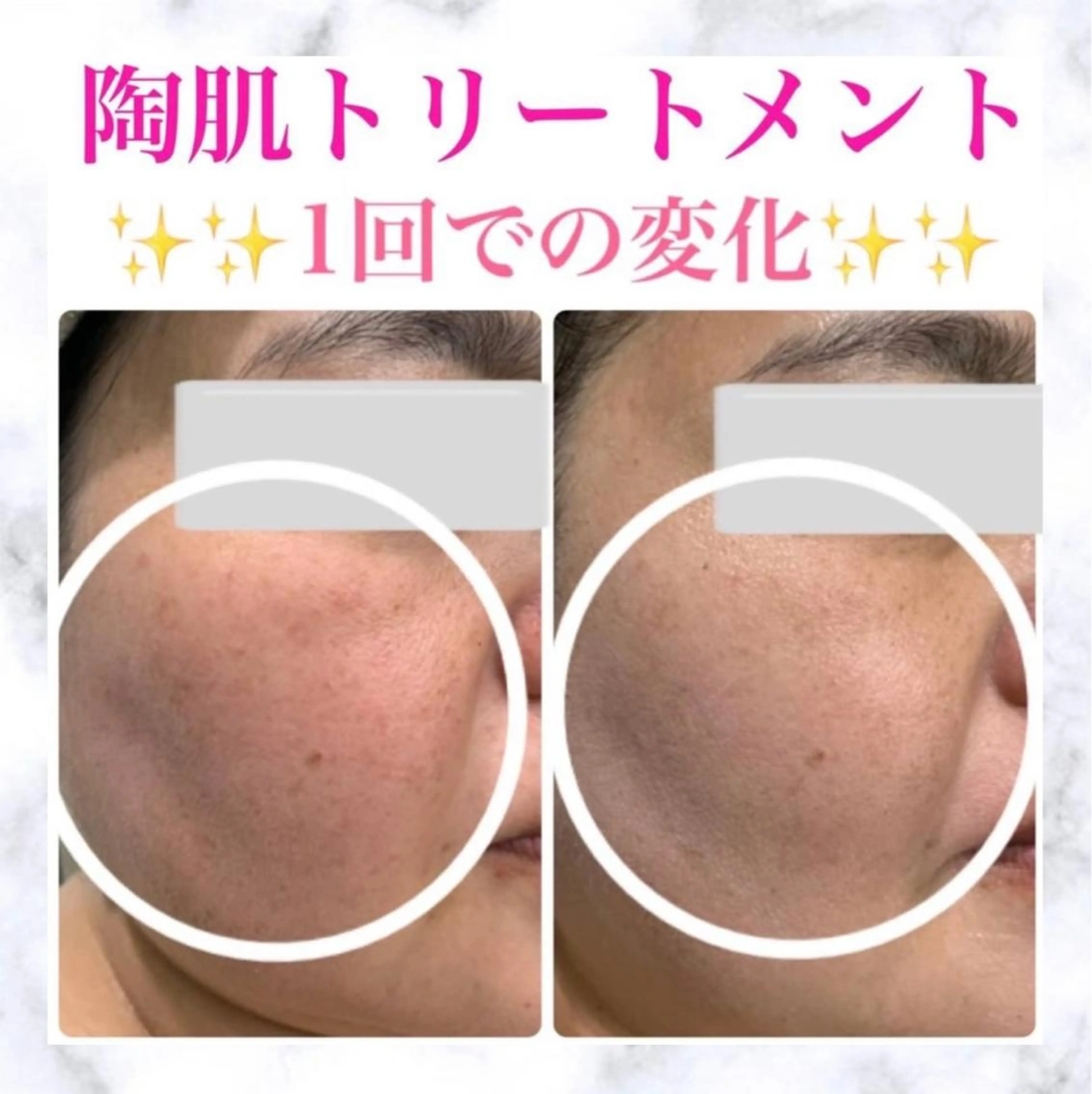 Lumiere despoir所属・Lumiere despoirのエステ・リラクイメージ