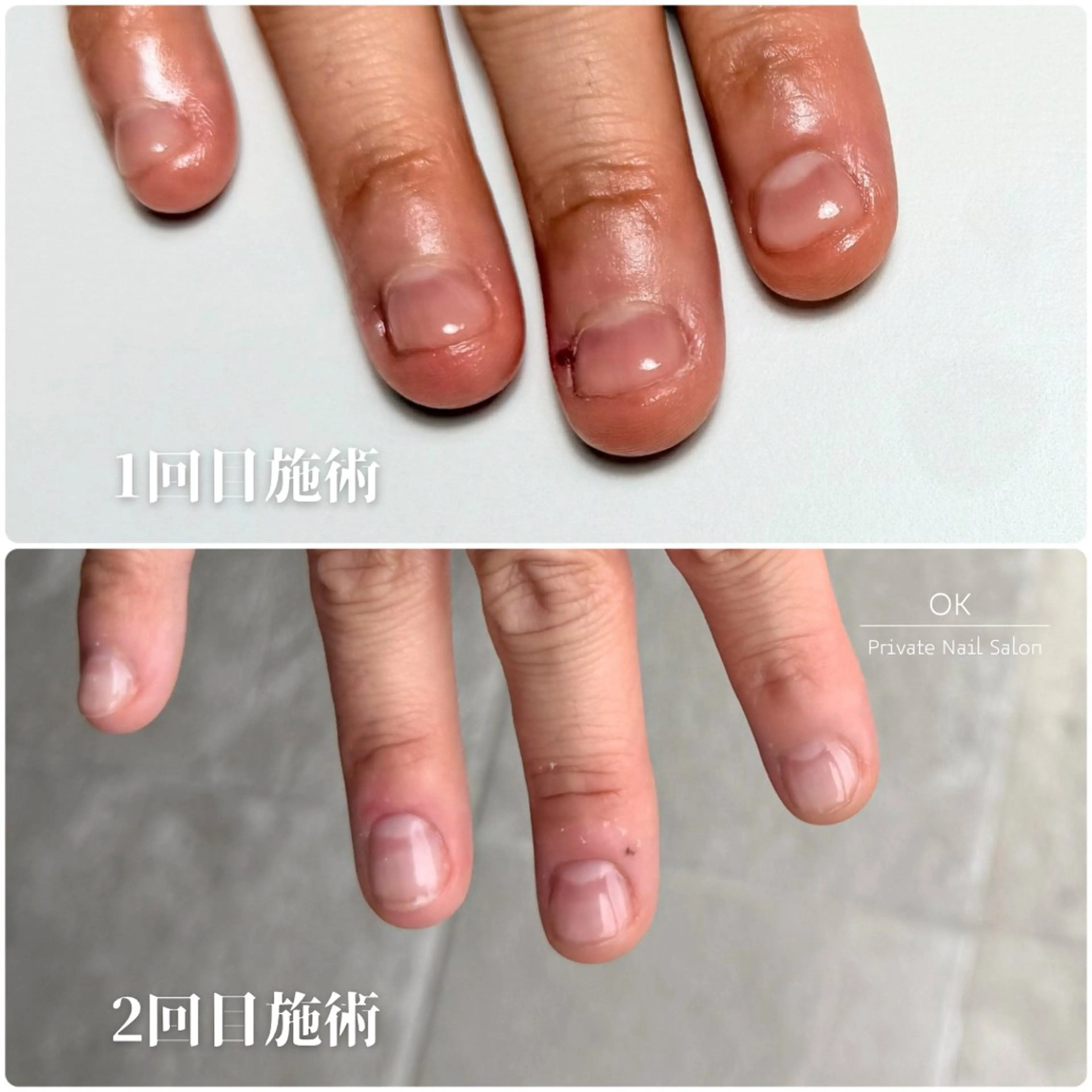 ネイル Private Nail Salon OK所属・FUKA ♡のネイルデザイン