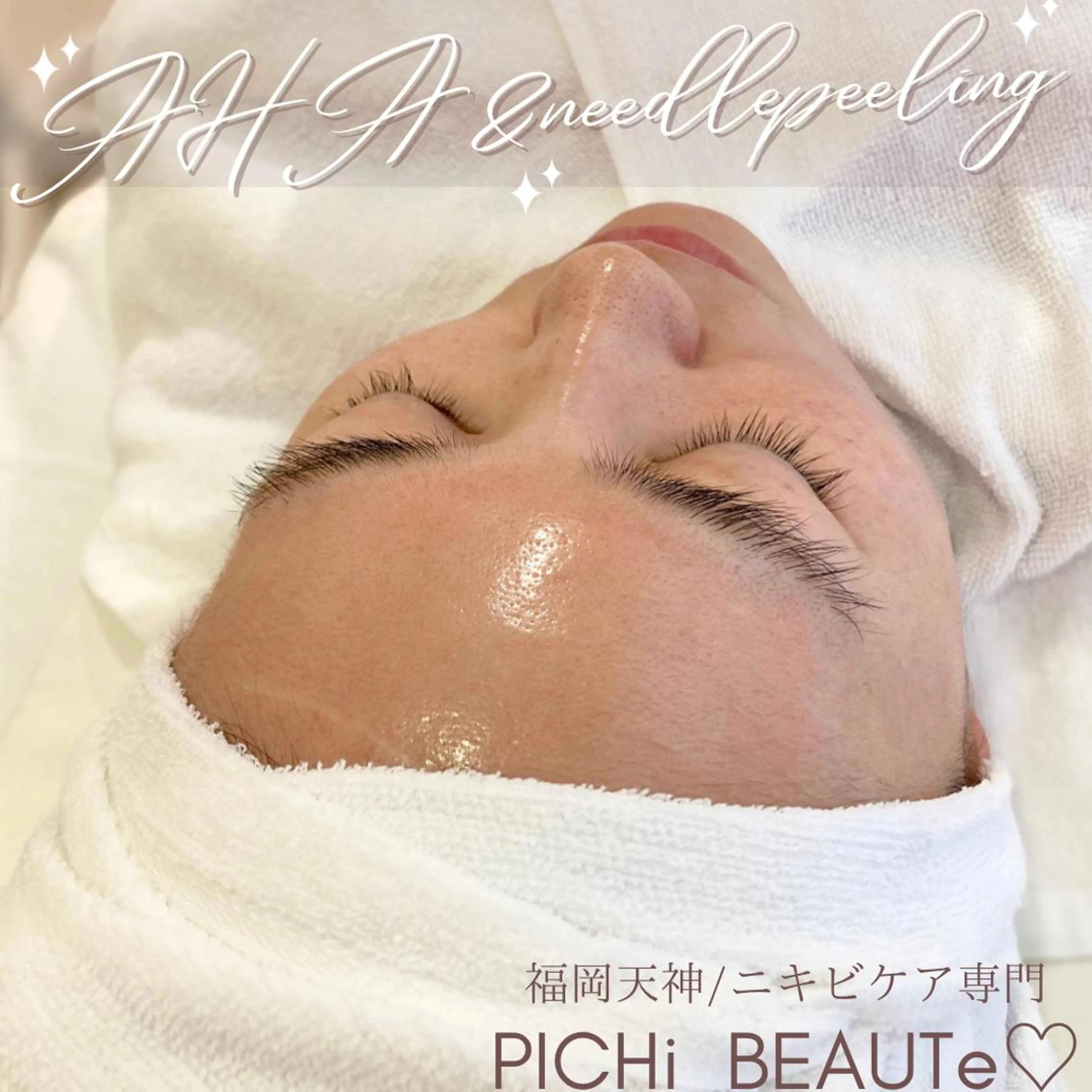 タルミ,ニキビケア専門PICHi BEAUTeピチボーテ所属・トクシゲ マホのエステ・リラクイメージ