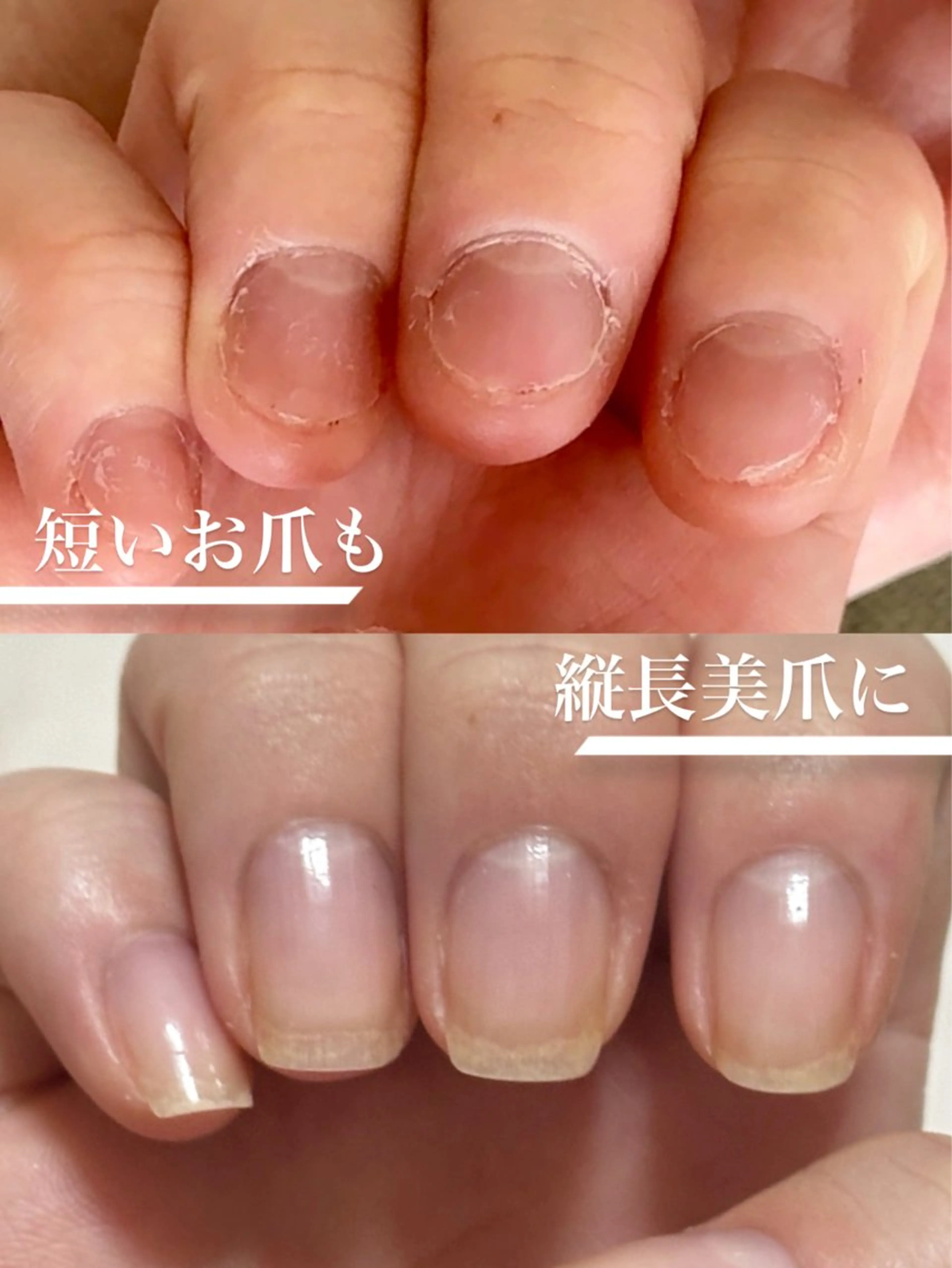 ネイル fote-自爪育成 ネイルケアサロン-のネイルデザイン