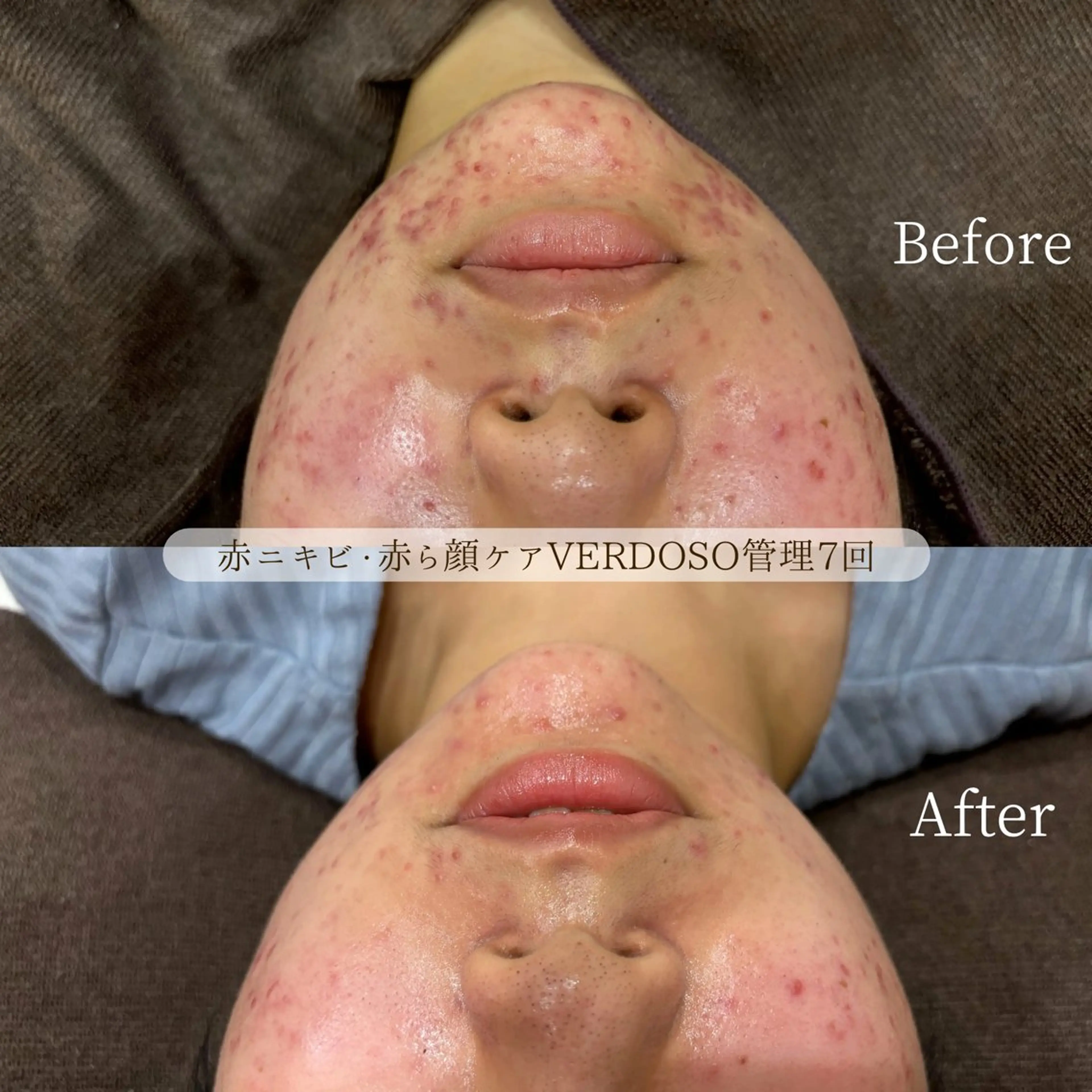 韓国風eyelush 眉毛サロン/Suuの眉毛・アイブロウイメージ