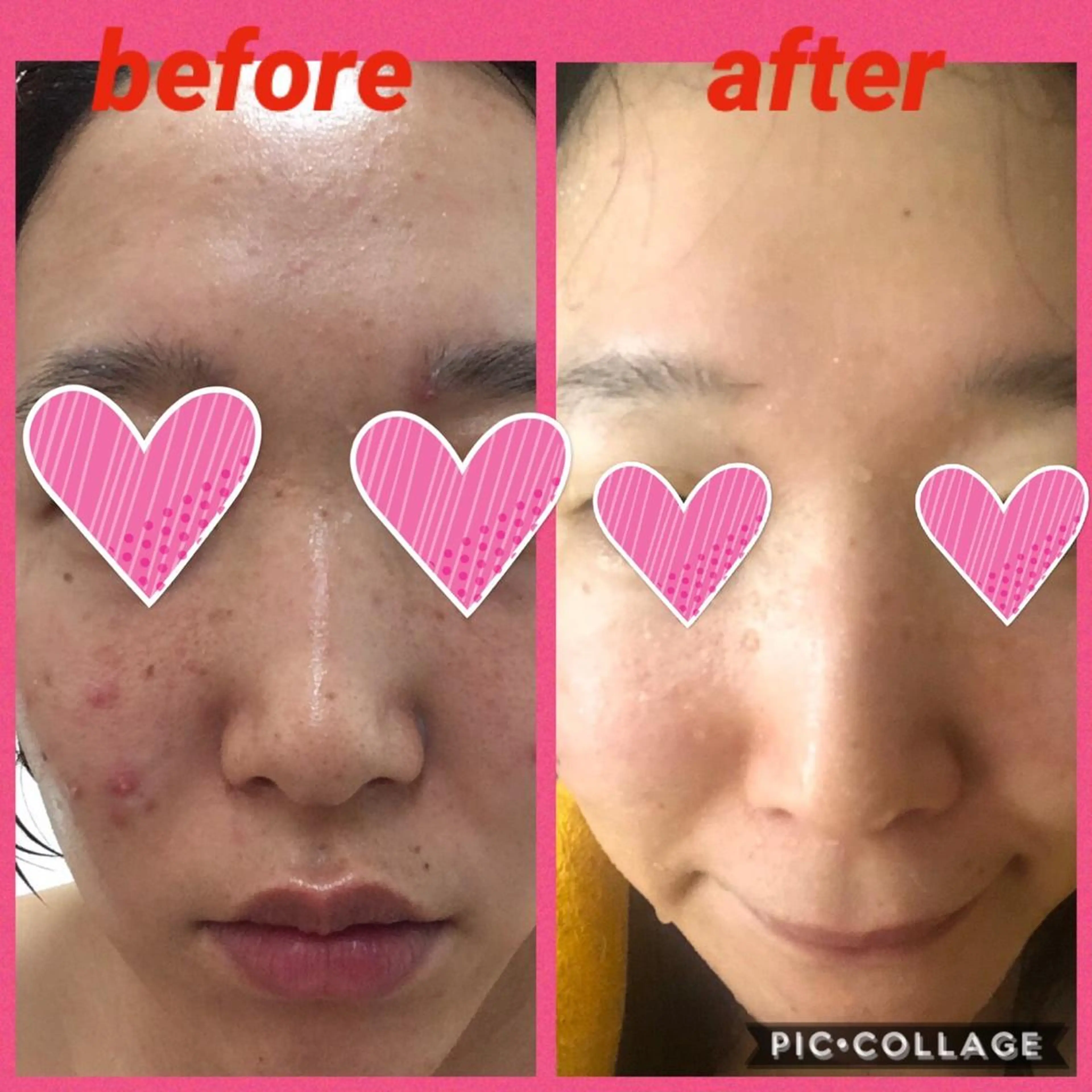 🌟痩身＋透明感ある美肌へ🌟🌿全身リンパマッサージ＋ruruonn＋引き締め小顔マッサージ＋美容液たっぷりパック❤️の写真