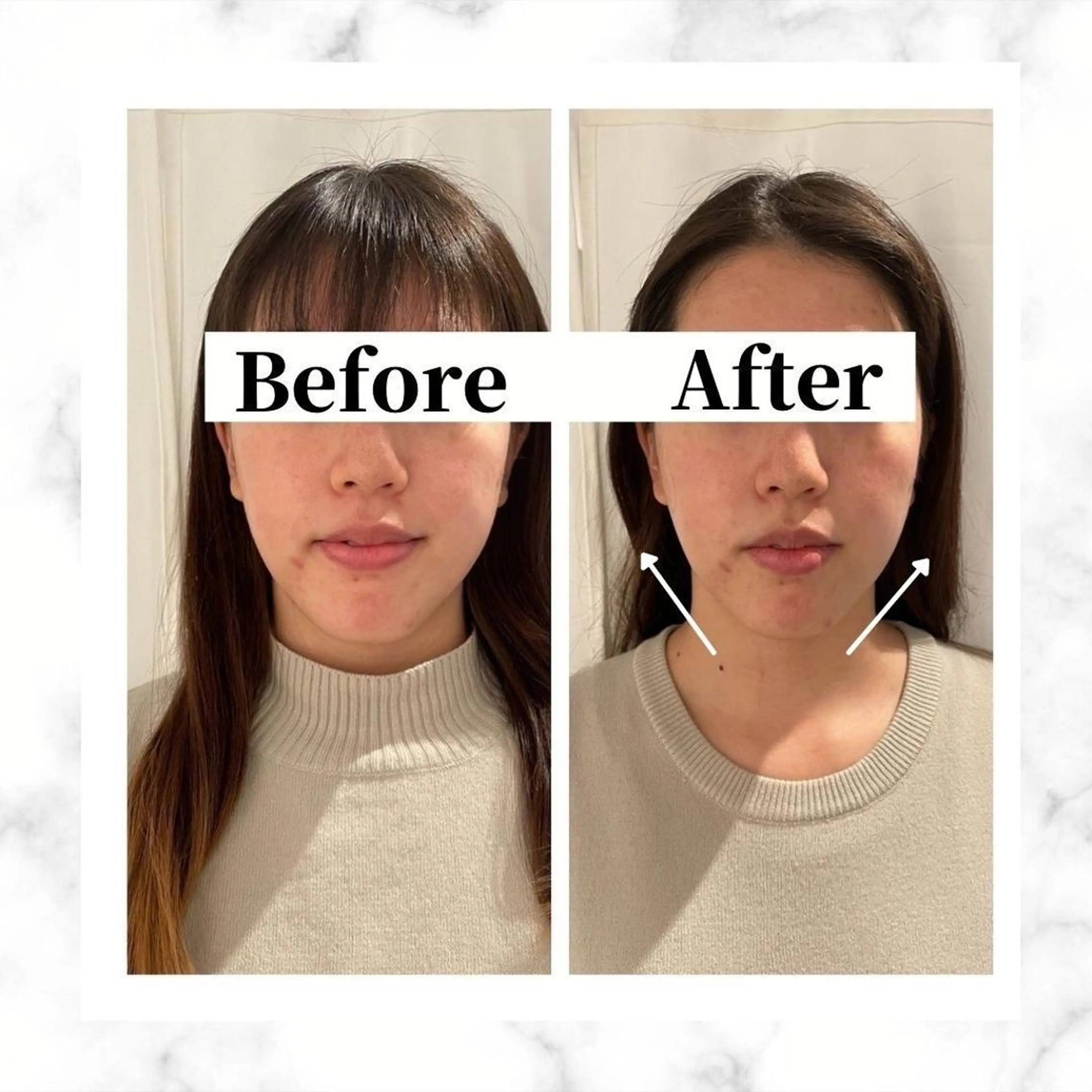 エステ リラク 12Dハイフ💗 最強小顔のエステ・リラクイメージ