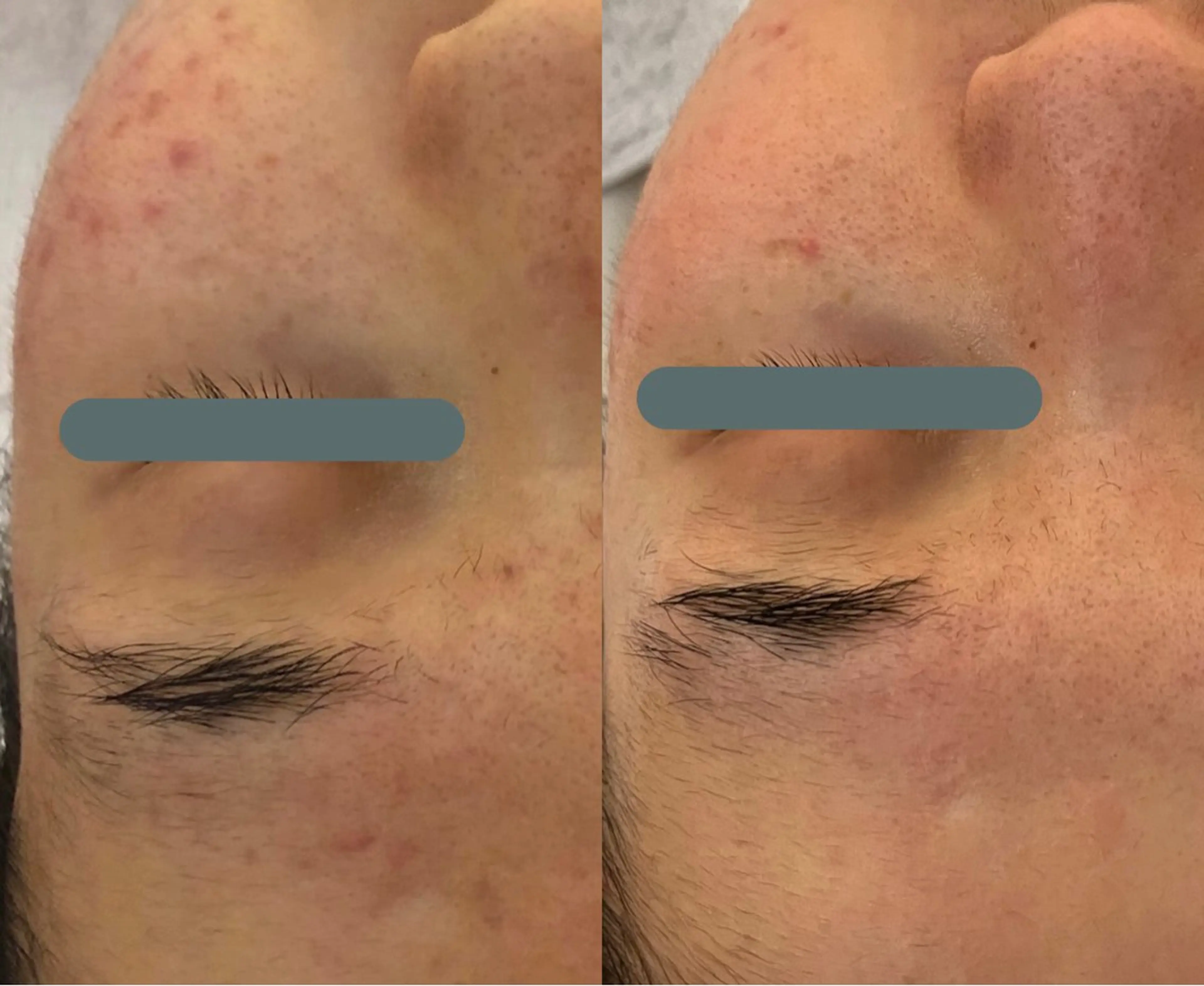 エステ リラク デアイム東広島所属・中井 小春のエステ・リラクイメージ