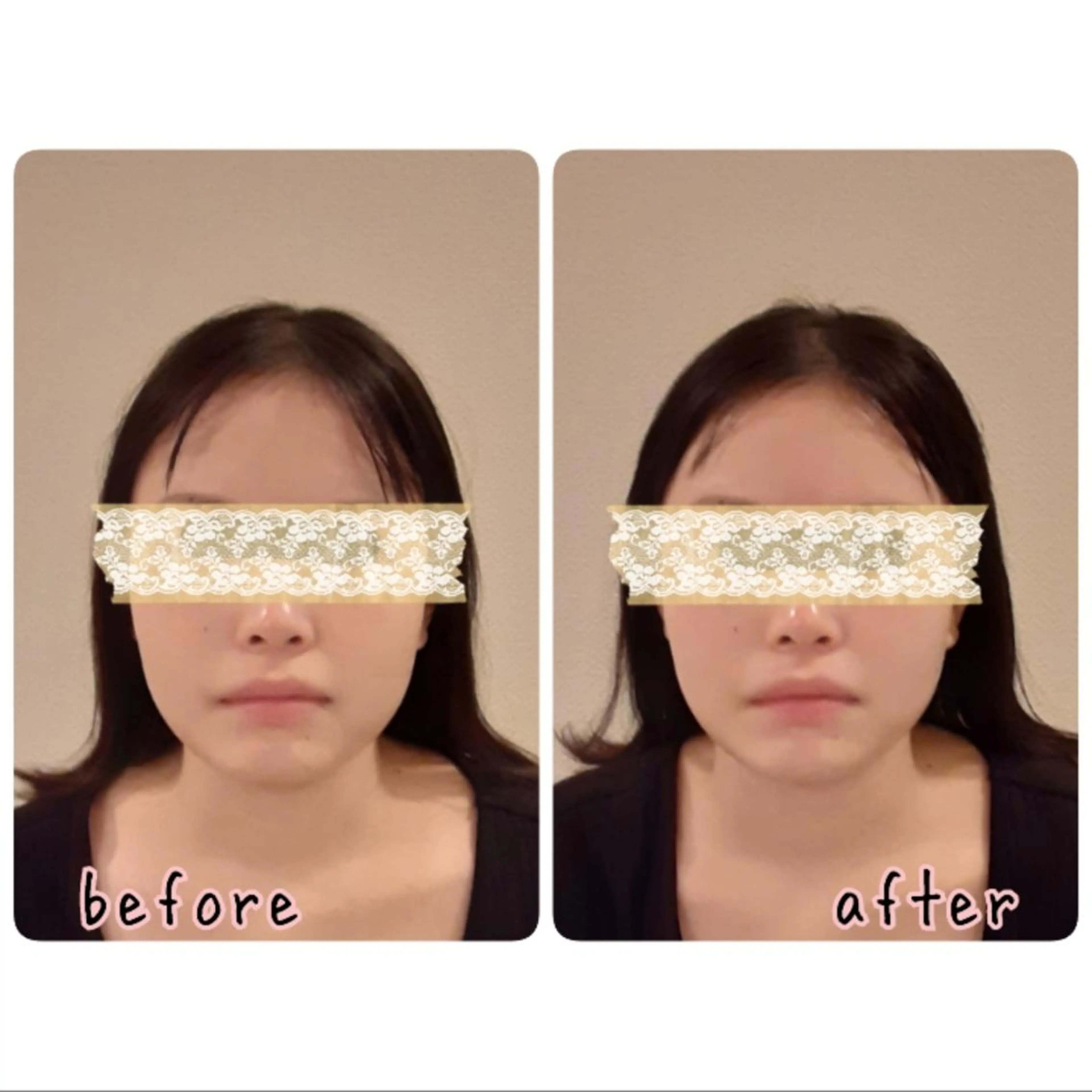 エステ リラク 女性専門 Luna time 整体院所属・Luna time  整体院　金子ゆかのエステ・リラクイメージ