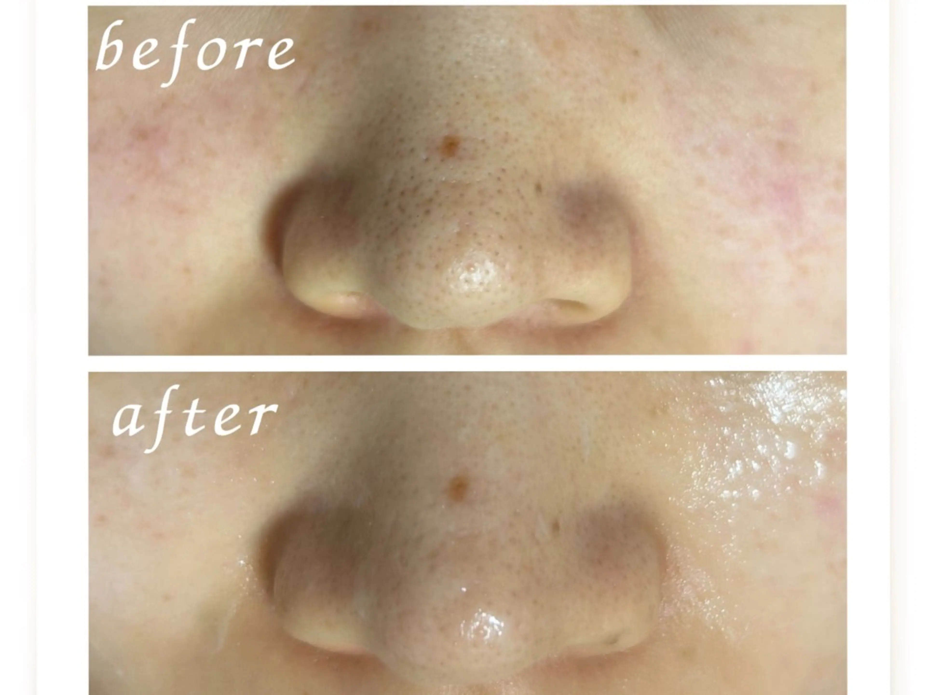 ホワイト ターコイズのエステ・リラクイメージ