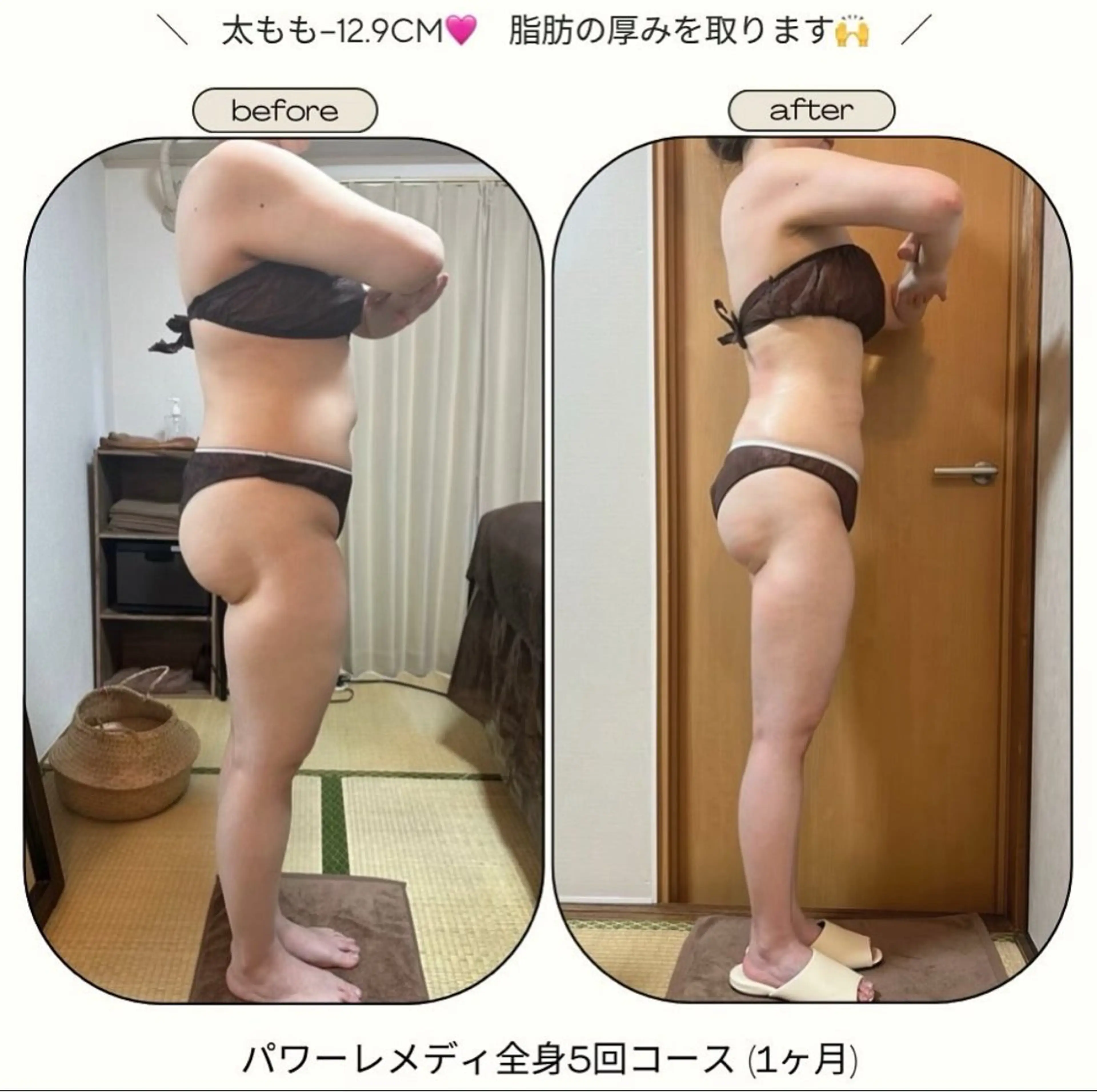 biloop所属・《本気痩せ×疲労改善 》  BILOOPのエステ・リラクイメージ