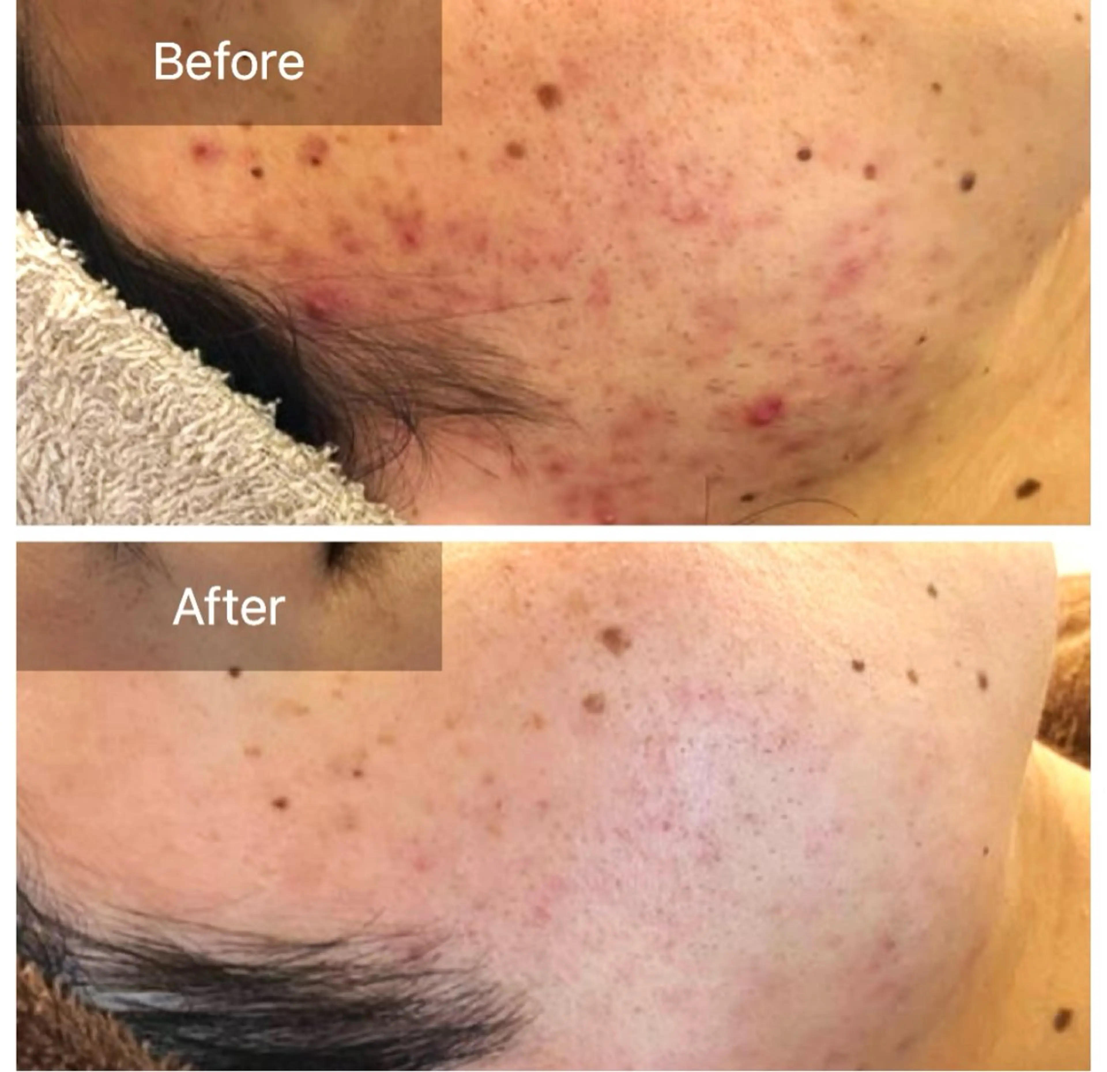 エステ ハーブピーリング 専門／今榮麻美のエステ・リラクイメージ