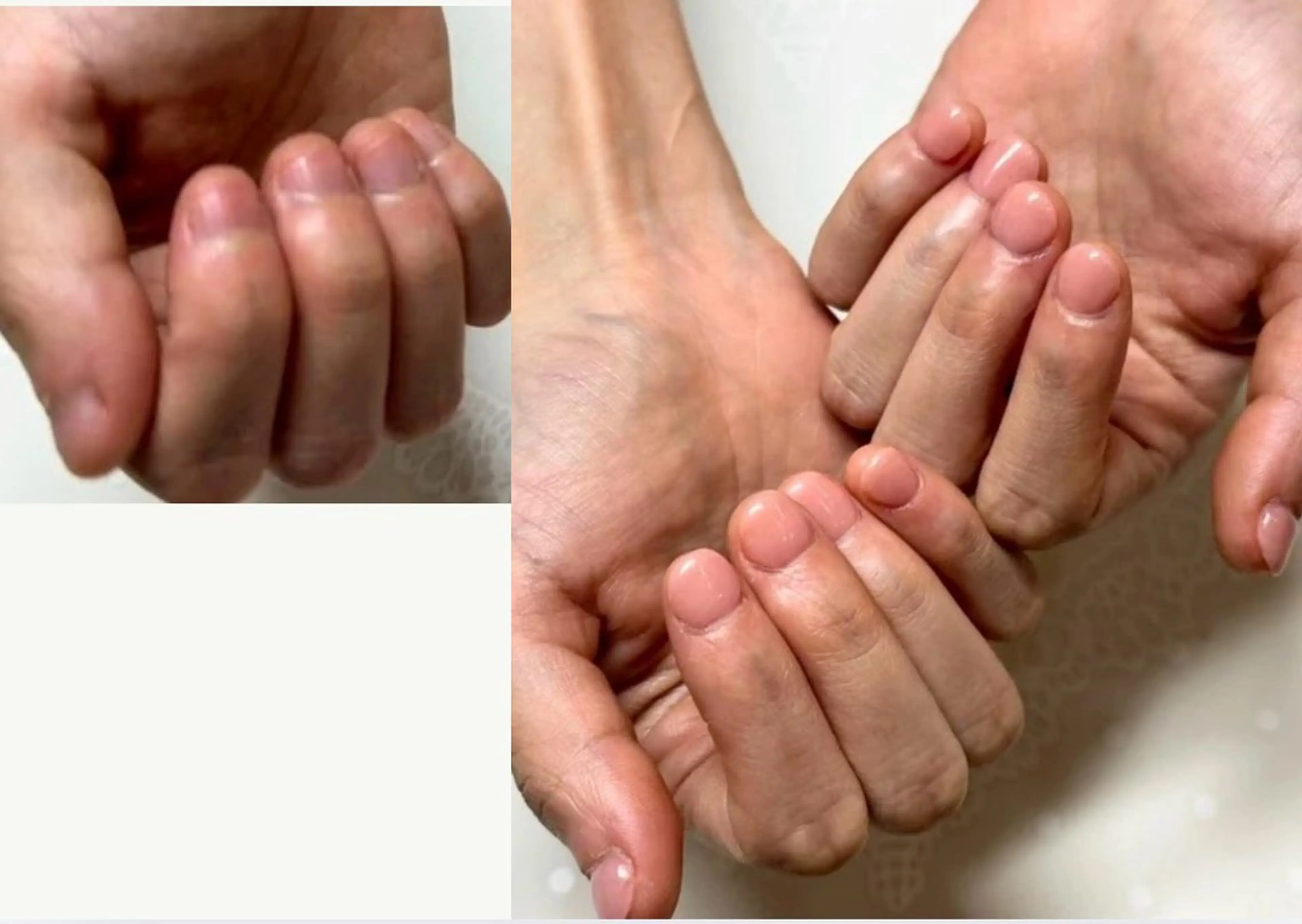 ネイル 深爪矯正専門サロン　ルソア所属・深爪矯正専門サロン ルソアのネイルデザイン