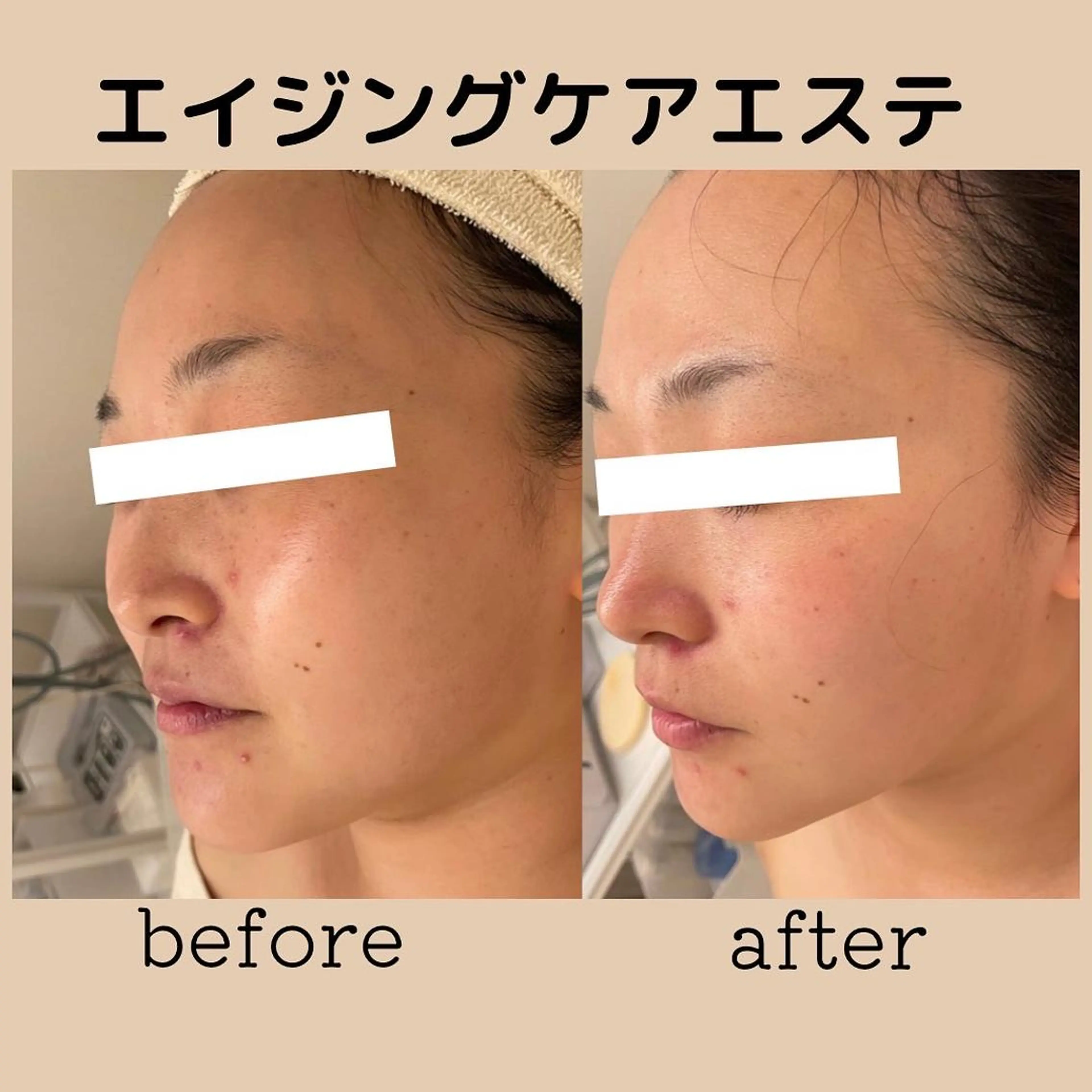 DeI'm   名古屋栄所属・小林 玲菜のエステ・リラクイメージ