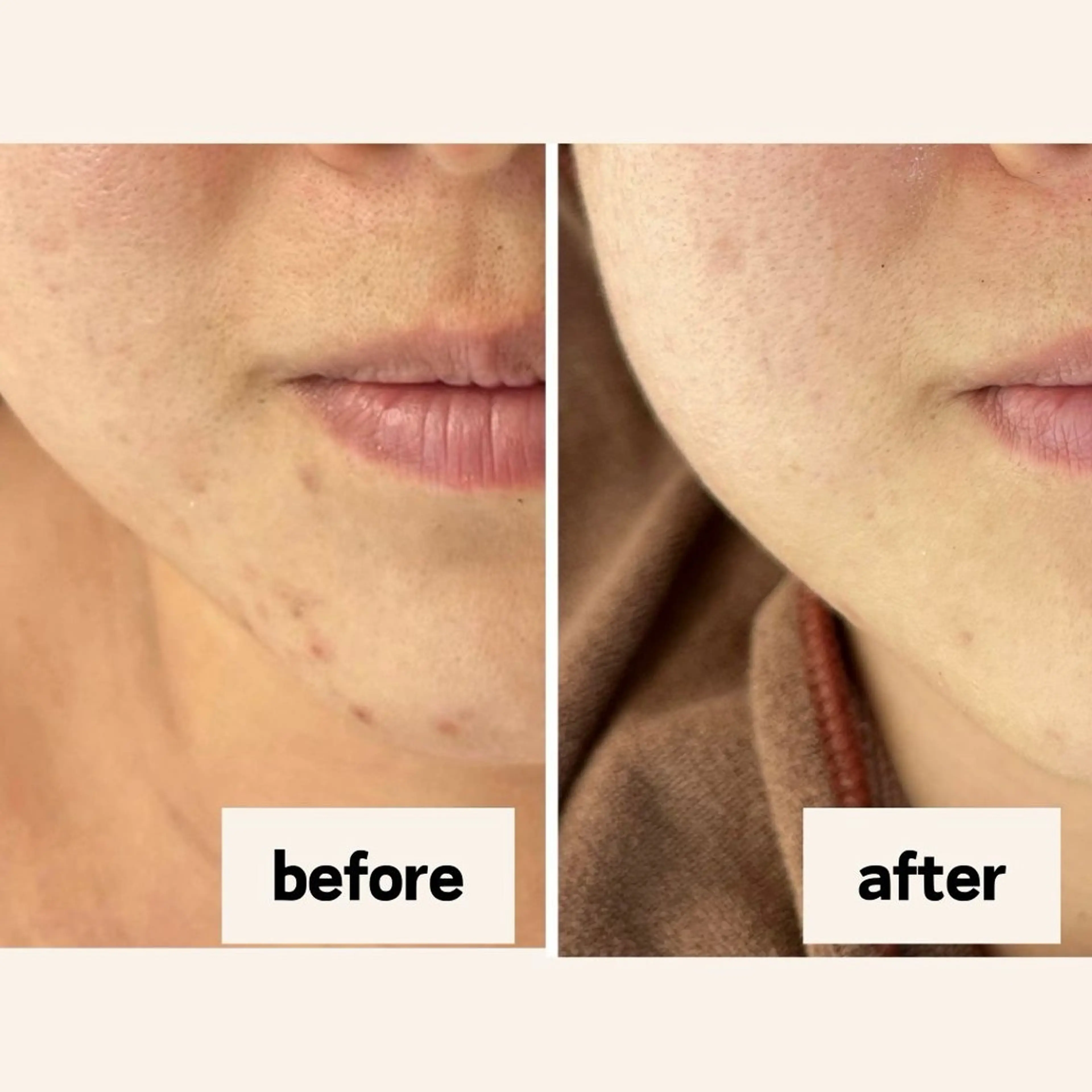 お肌と歯のサロン　Sona Mior所属・藤井 ののみのエステ・リラクイメージ