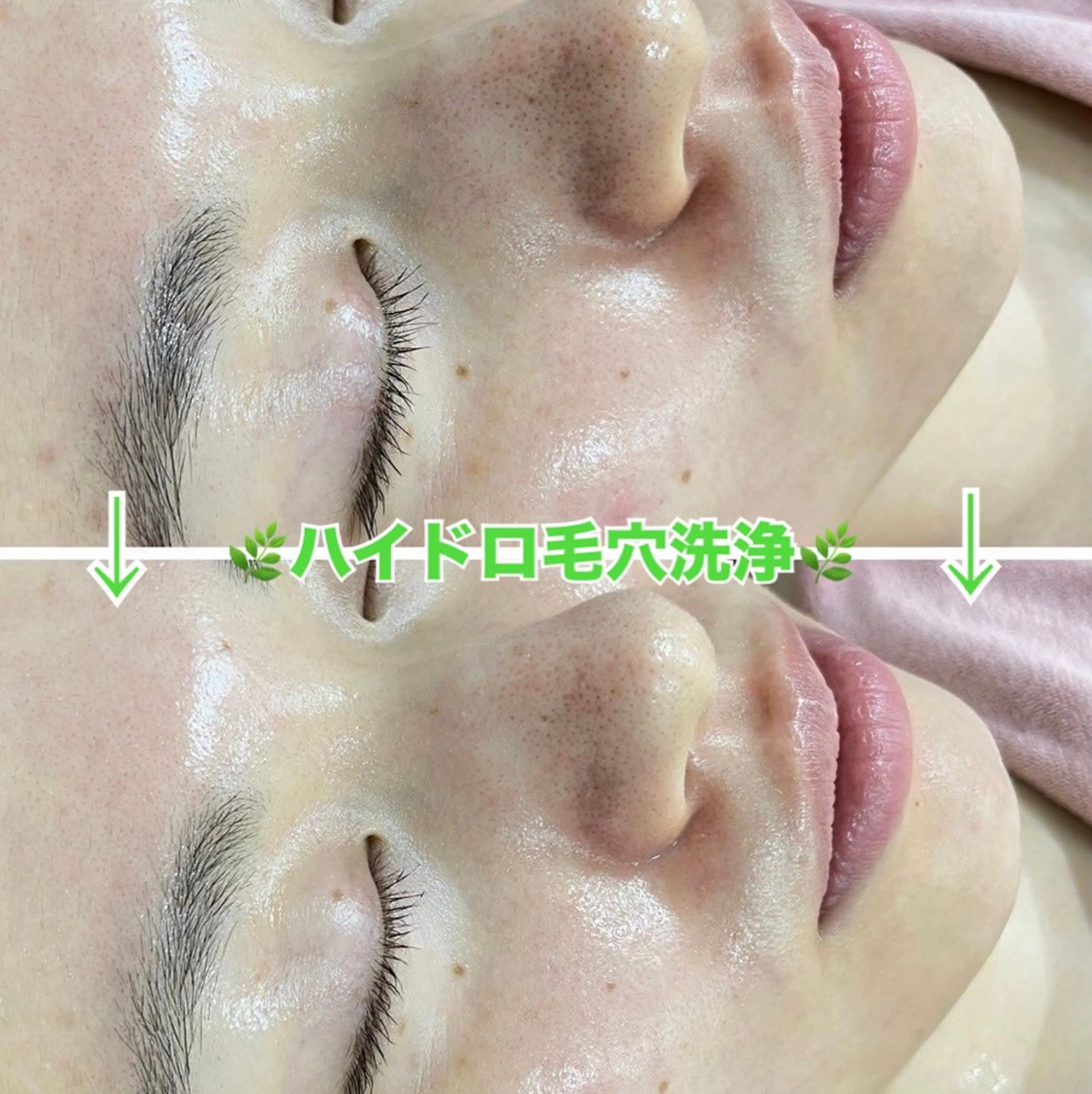 エステ 脱毛&美容サロン Dr.Epiのエステ・リラクイメージ