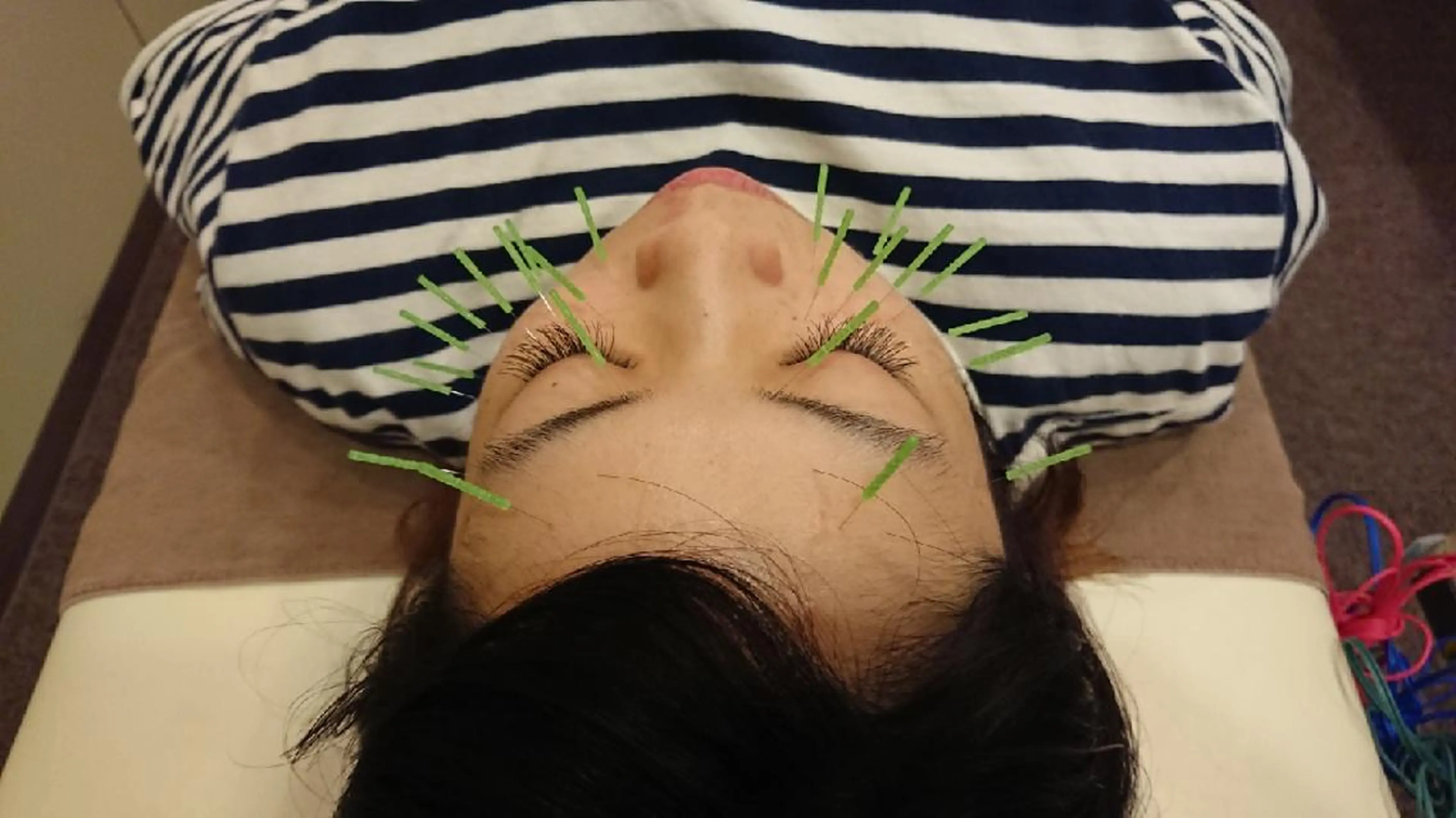 鍼灸サロンKEYAKI所属・美容鍼灸師 皆吉 秀樹のエステ・リラクイメージ