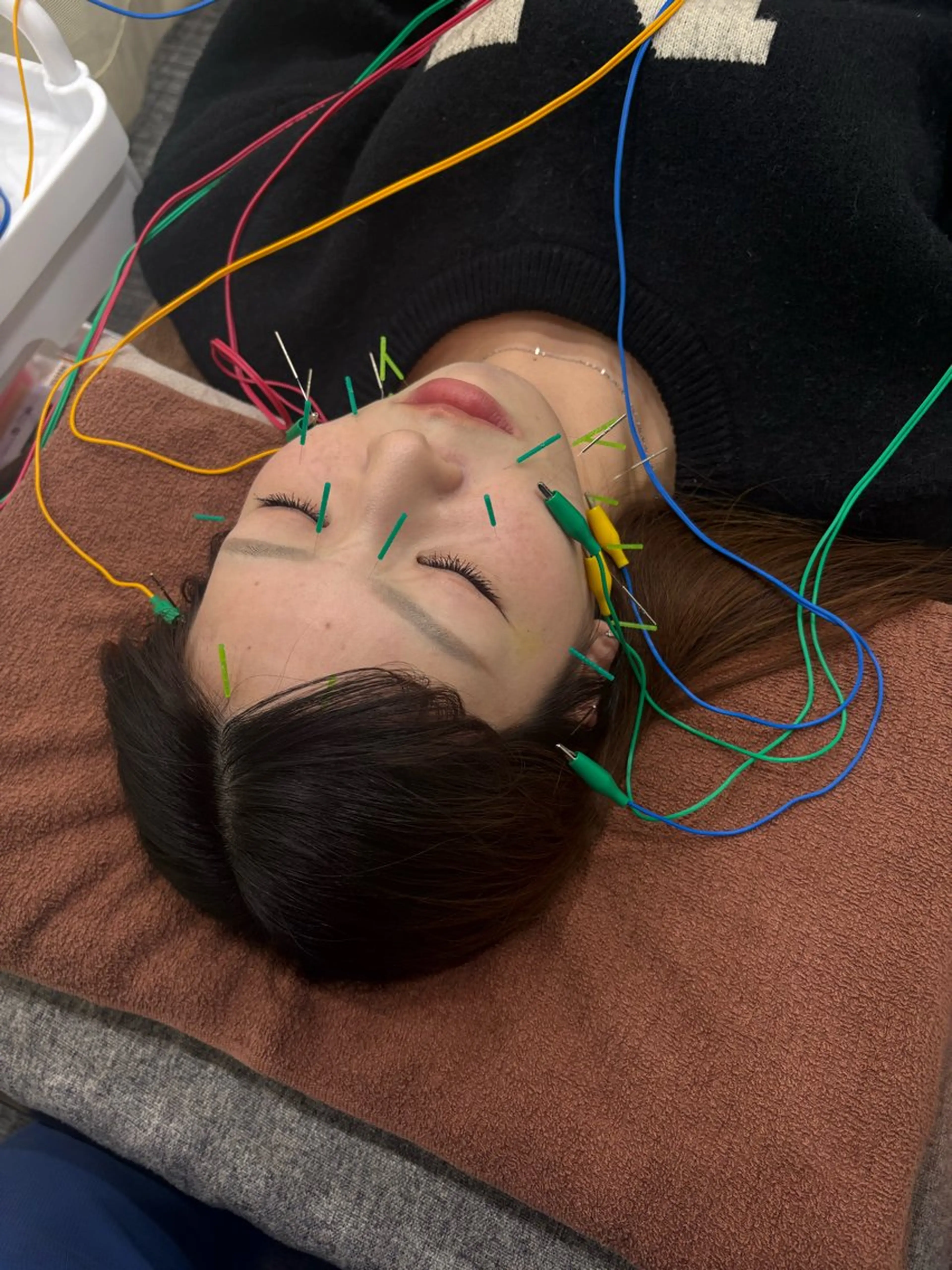 リラク 小林整骨院 天神所属・宮﨑 辰徳のエステ・リラクイメージ