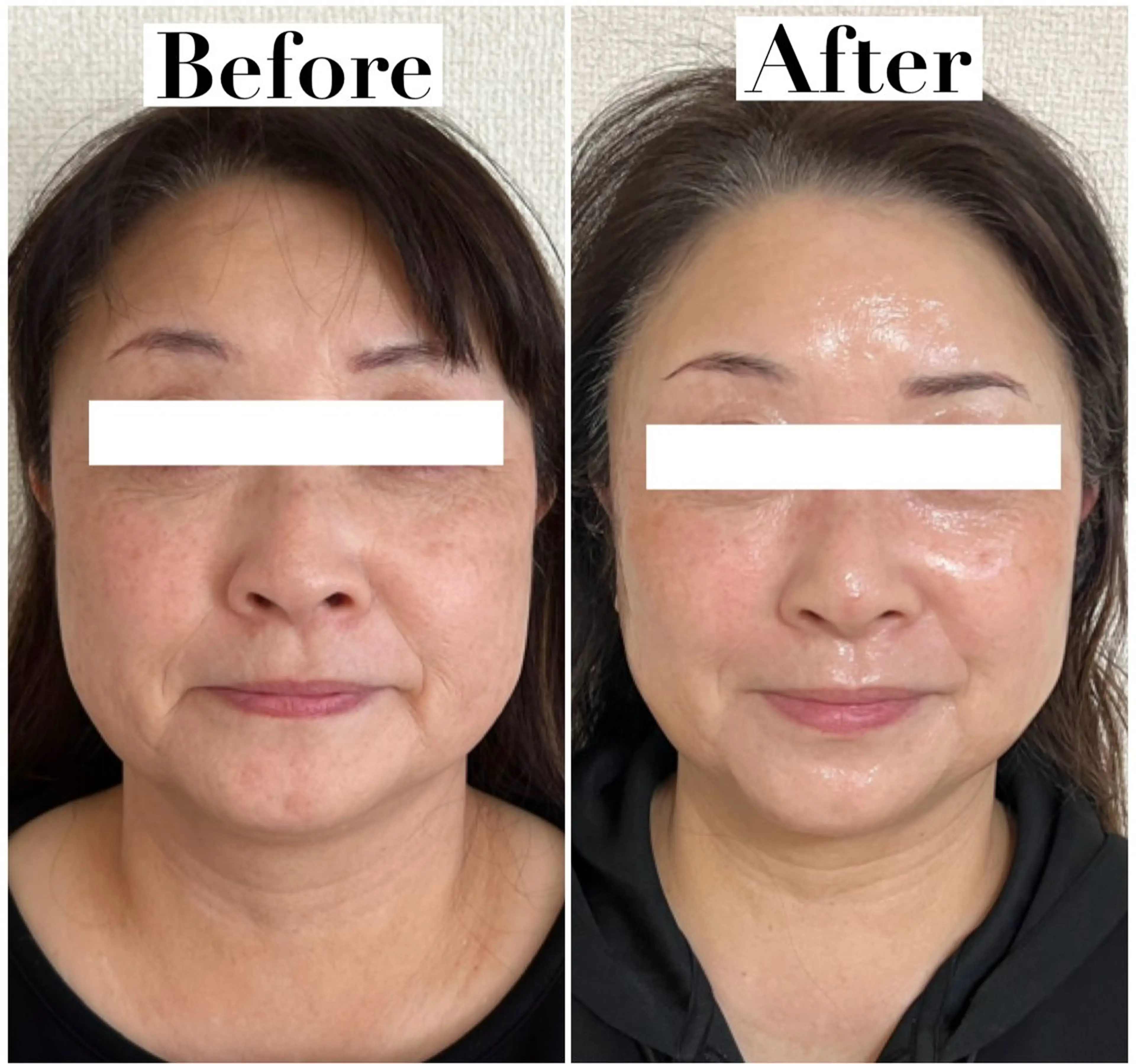 エステ リラク たるみ改善サロン Ｍdesignのエステ・リラクイメージ