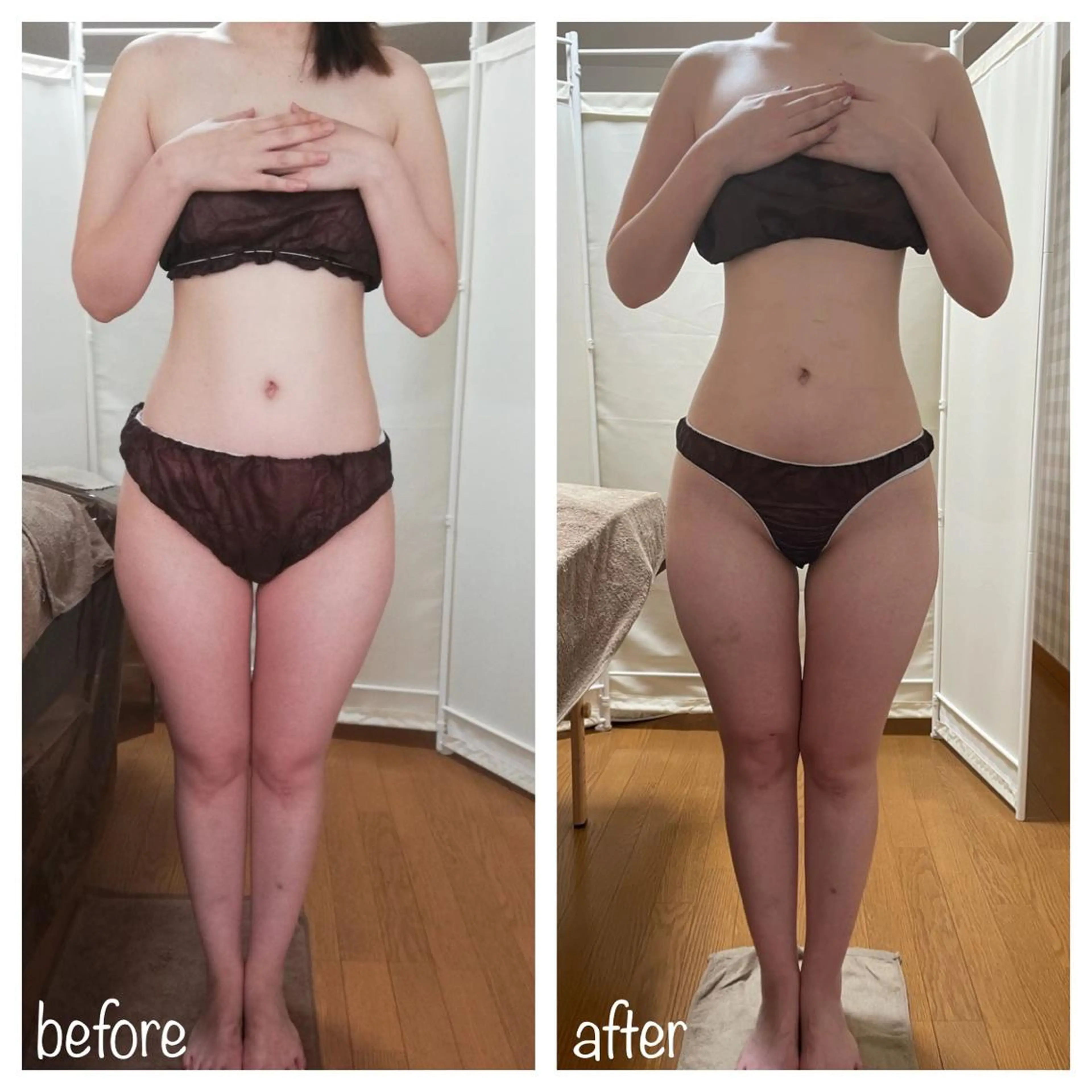 biloop所属・《痩身×疲労改善》 BILOOPのエステ・リラクイメージ