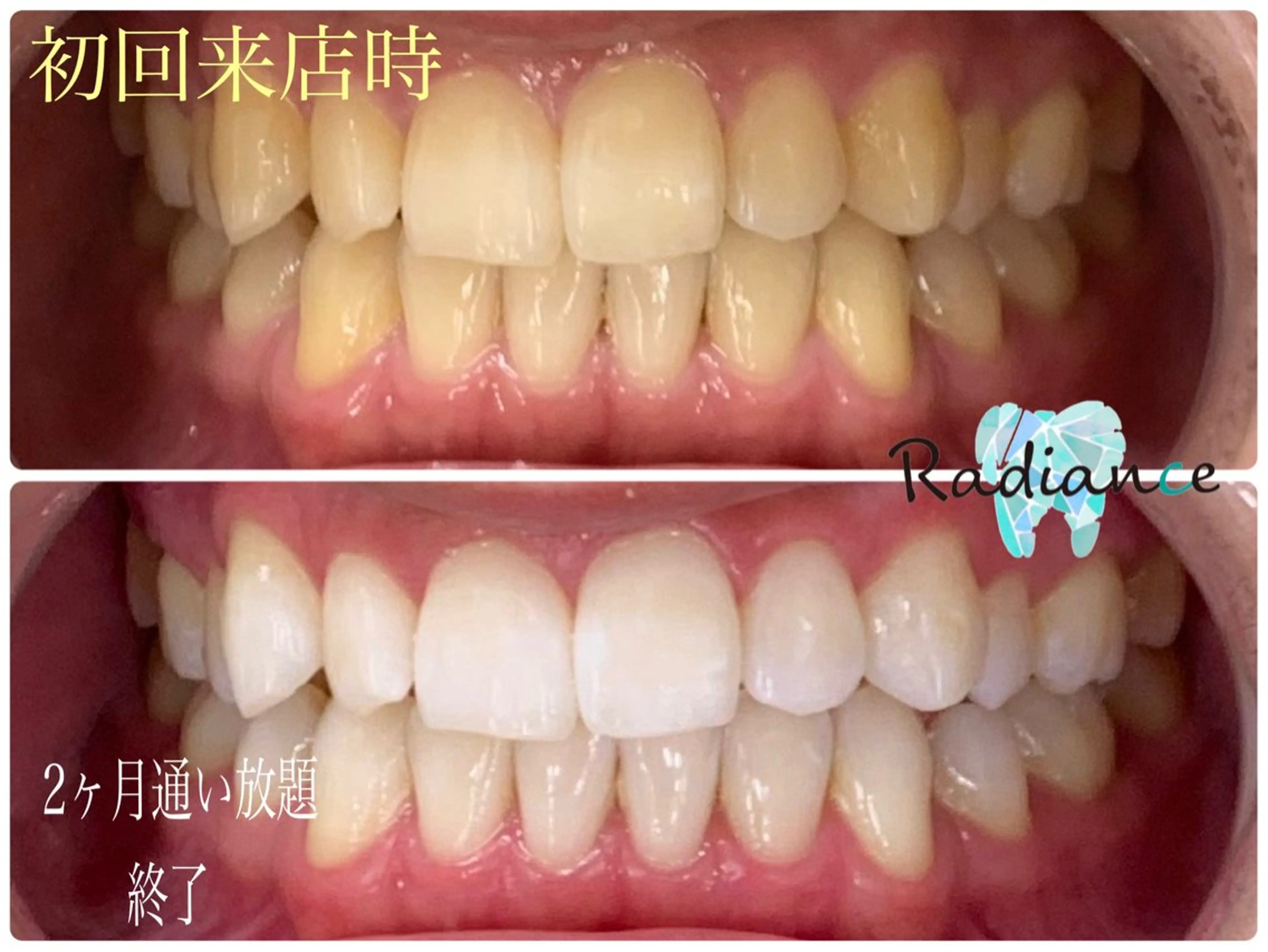 その他 札幌ホワイトニング ラディアンス札幌駅店のその他イメージ