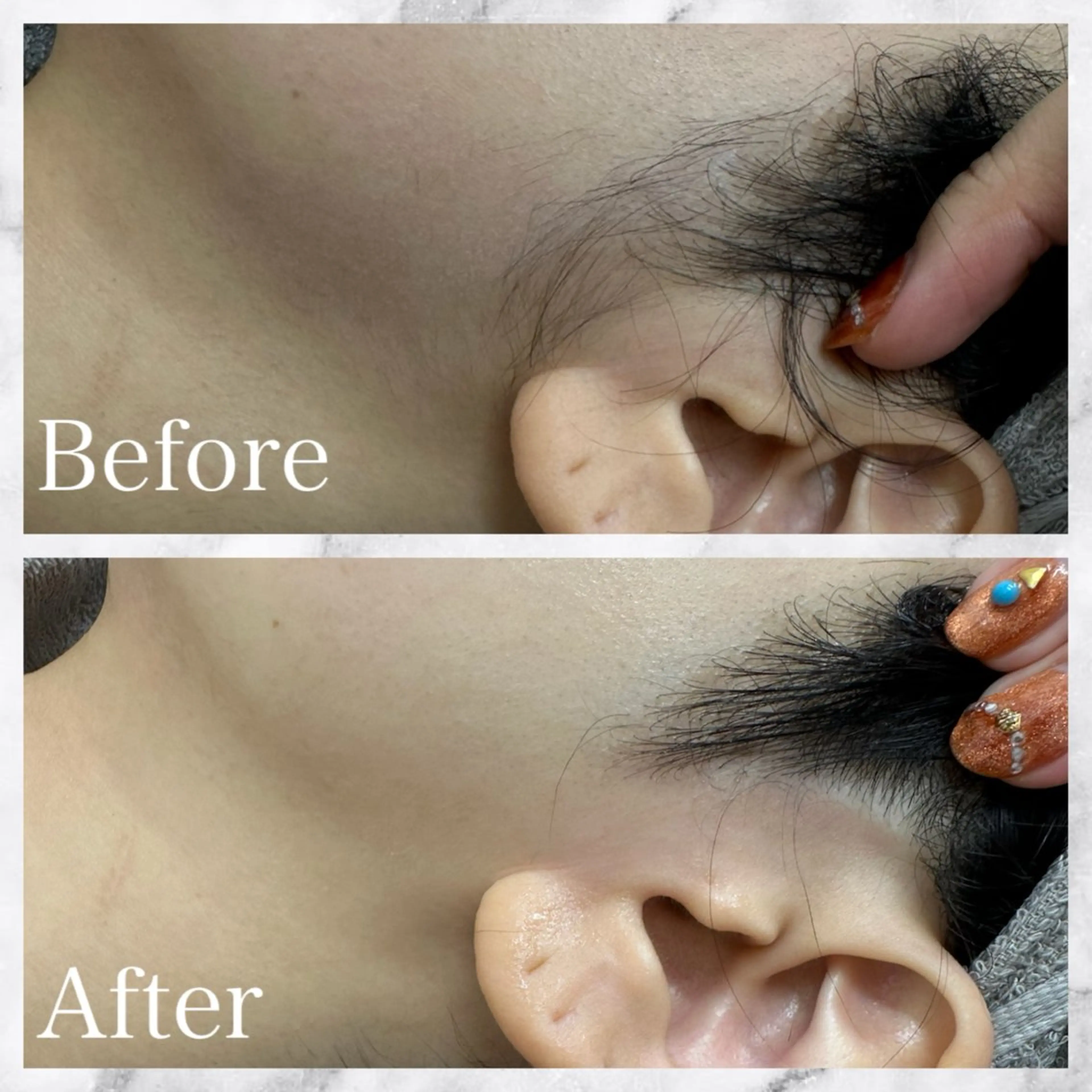 SKYCUT所属・SKY  CUT くるみのエステ・リラクイメージ