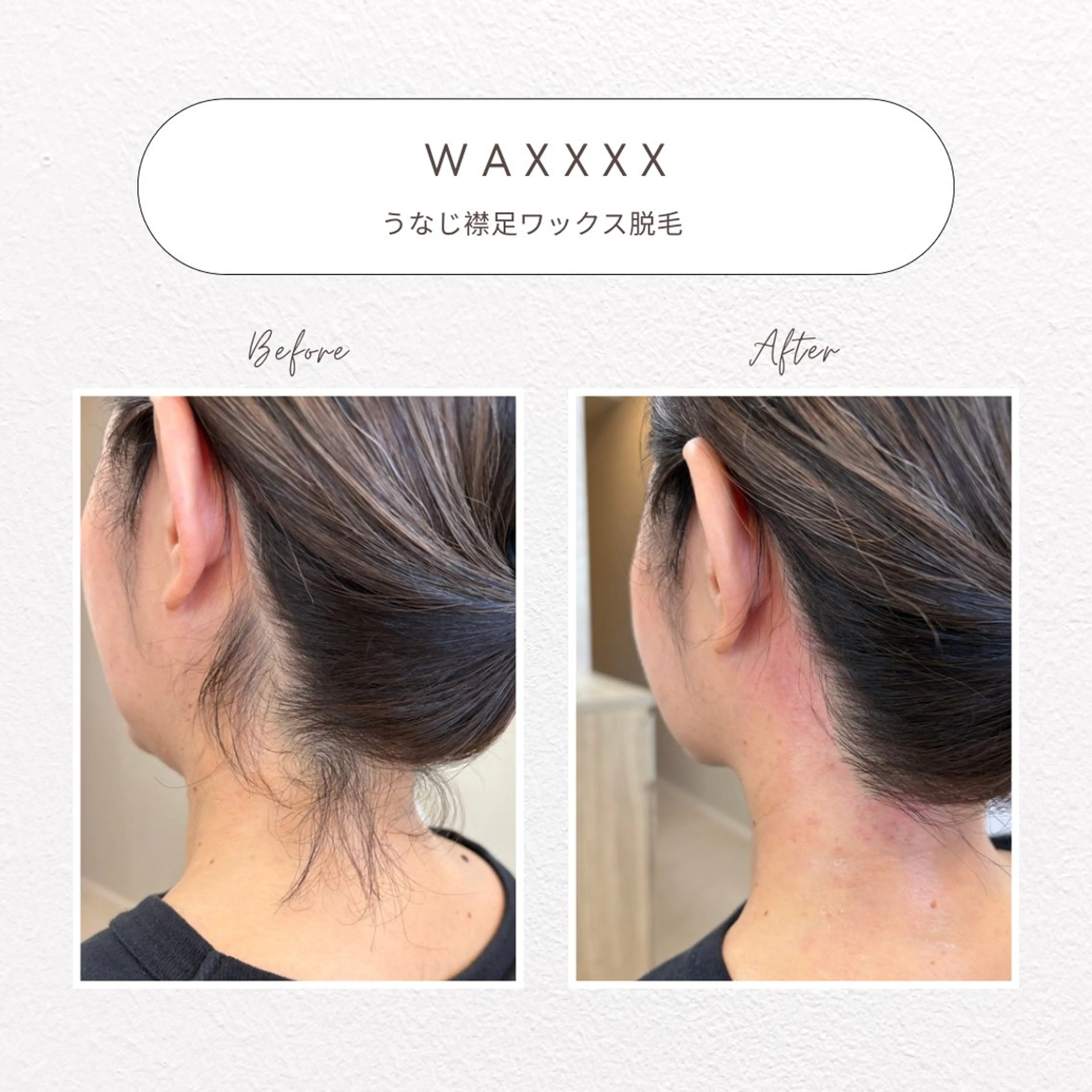 脱毛 beaute LABO所属・大宮肌管理サロン sayakaのエステ・リラクイメージ