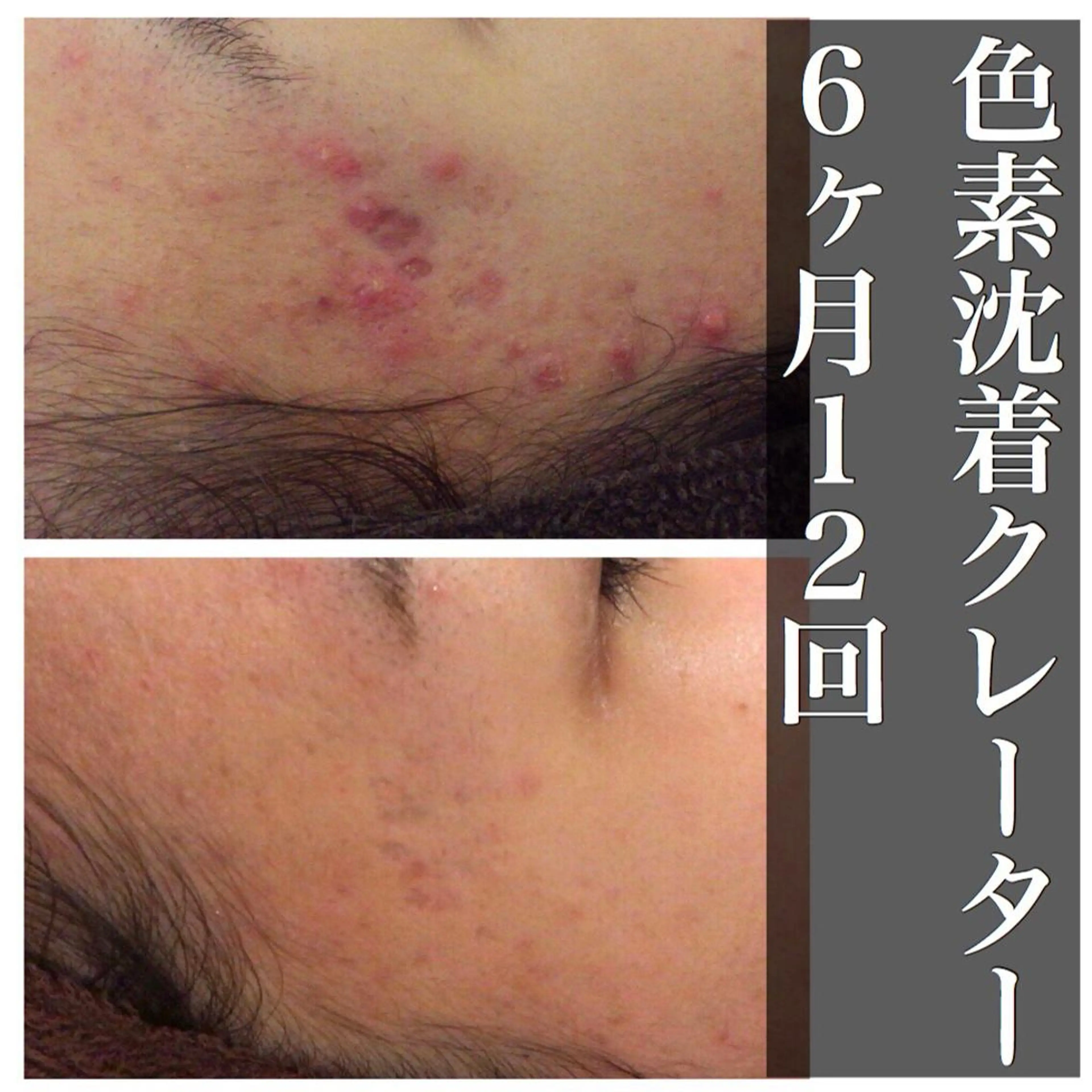 ミディアム カラー パーマ ヘアアレンジ メンズ キッズ ネイル マツエク・マツパ 赤色 エステ リラク ニキビ・肌質改善専門 ♡人生が変わるサロンのエステ・リラクイメージ