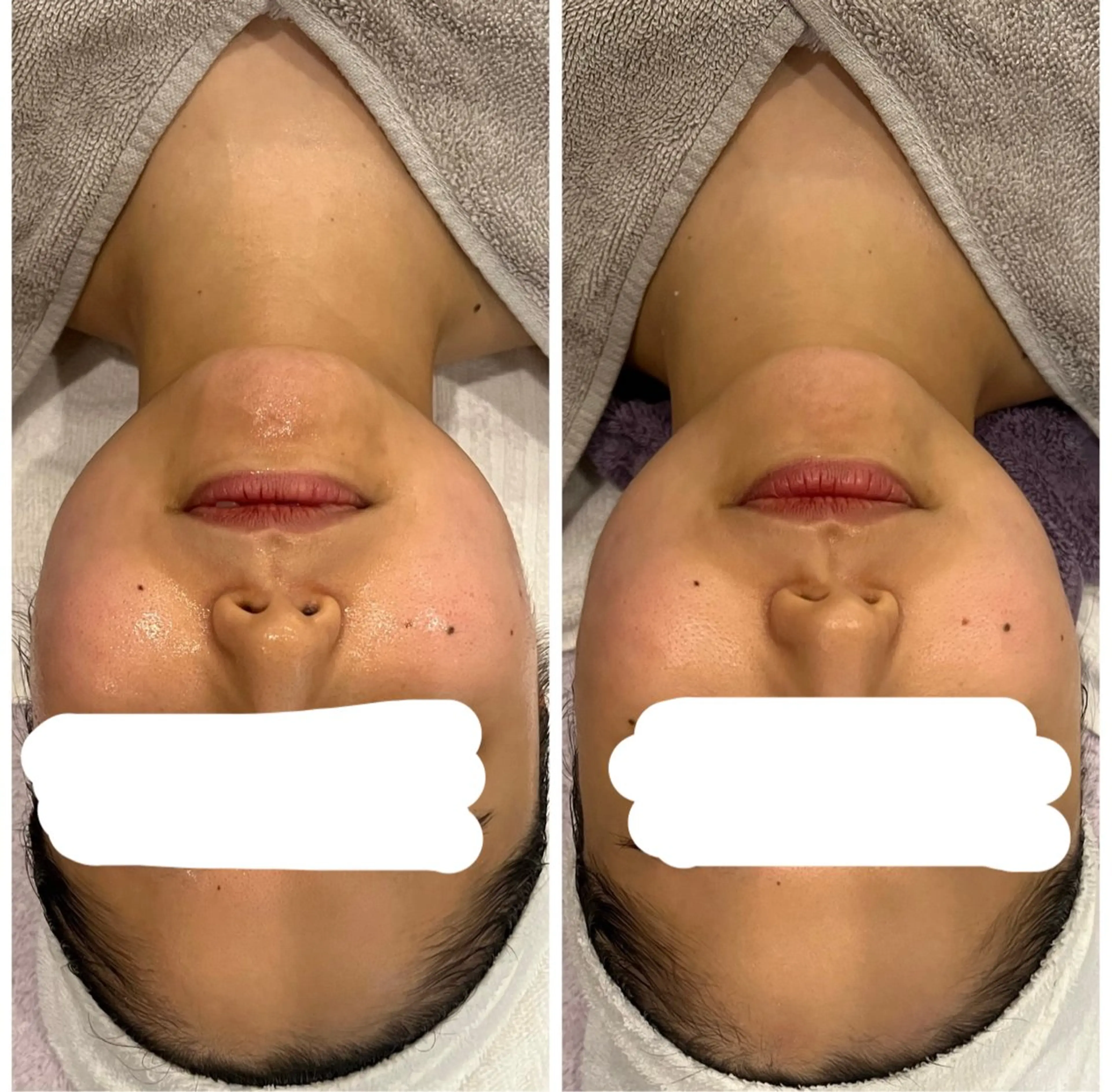 丸の内ヒルズ 鈴木麻瑚のエステ・リラクイメージ