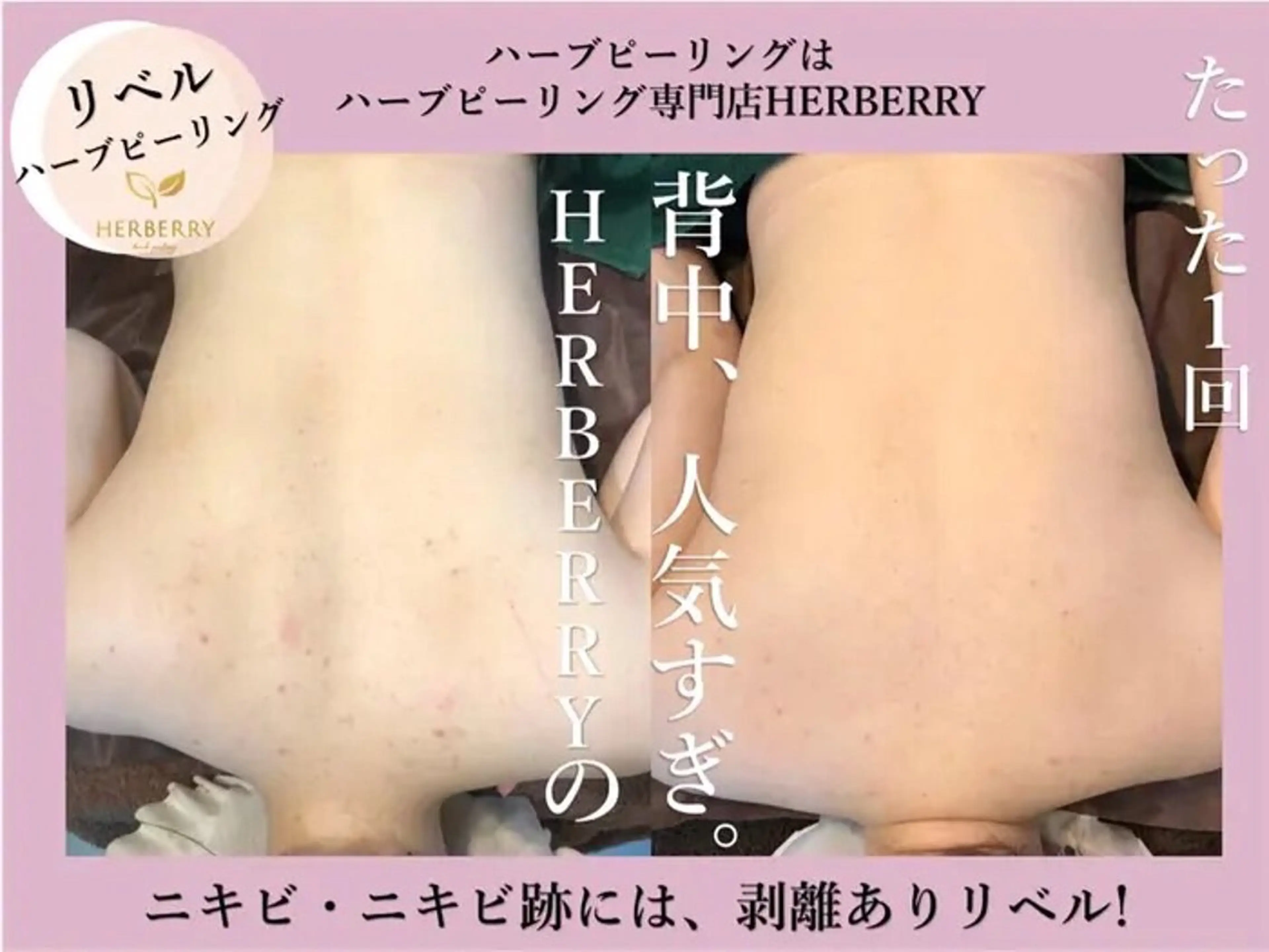 ハーブピーリング専門店HERBERRY難波心斎橋店所属・ハーブピーリング専門 HERBERRY冨永のエステ・リラクイメージ