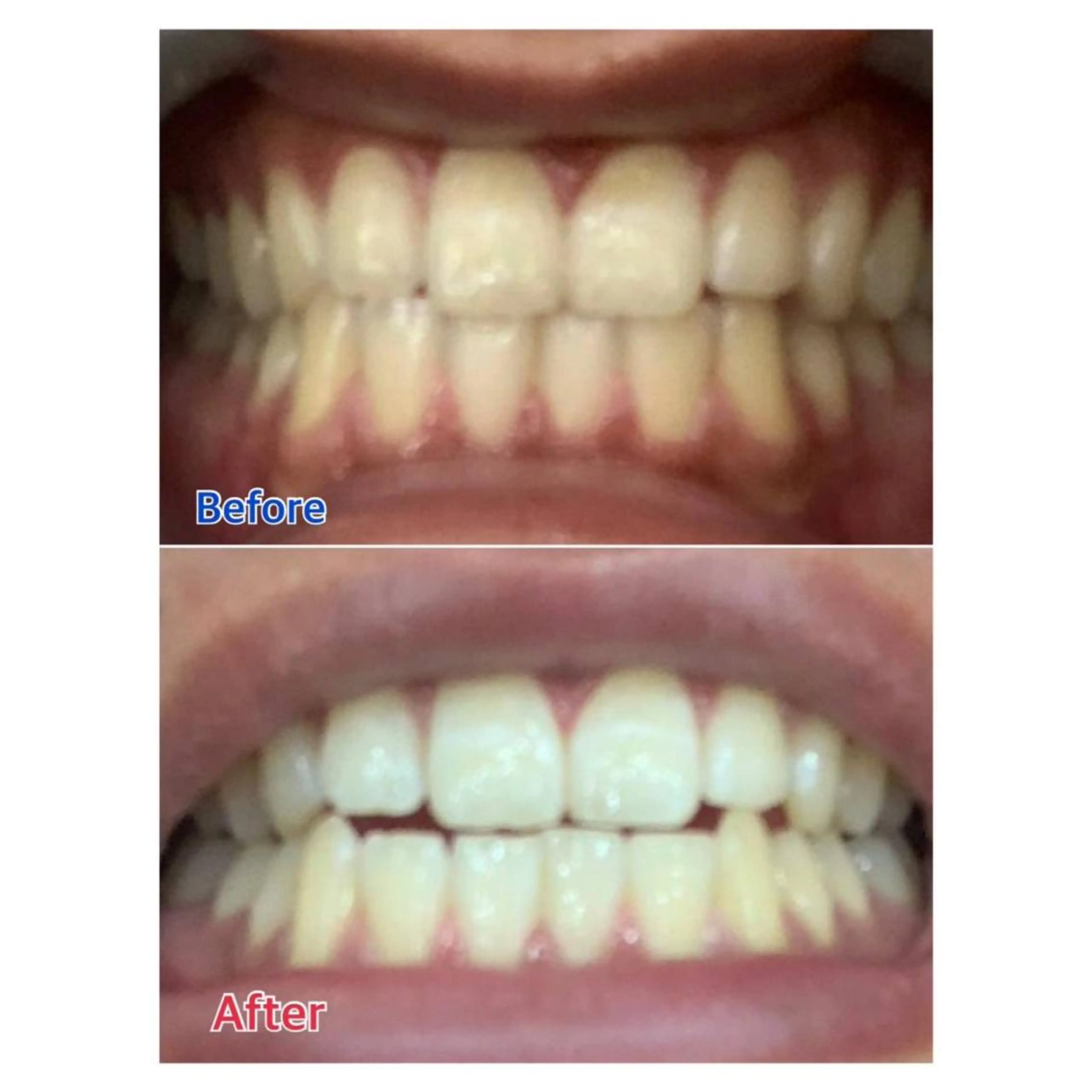 MBEAUTYSALON 千葉店・京成大久保所属・Melty 輝のその他イメージ