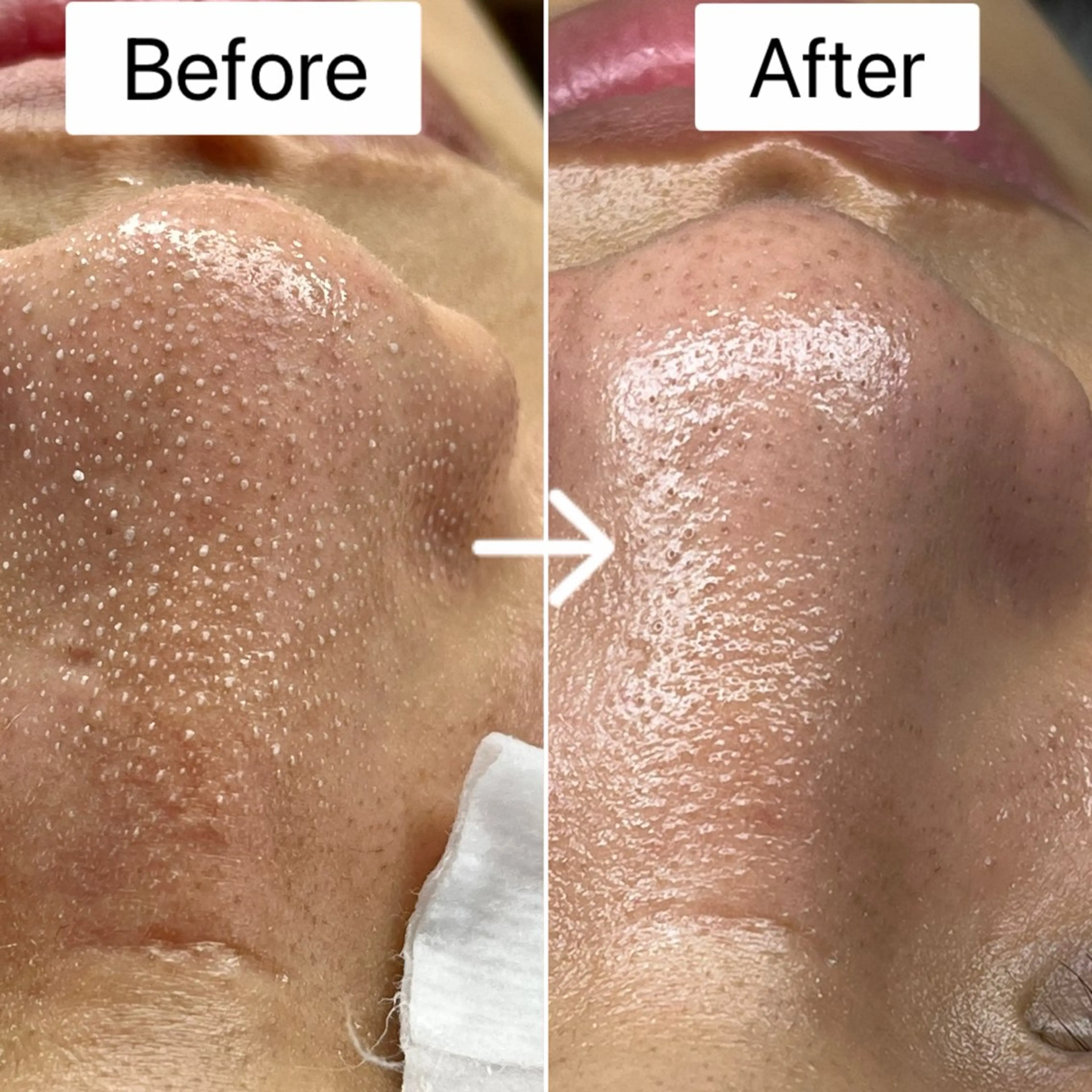 Blue Moon 【ブルームーン】のエステ・リラクイメージ