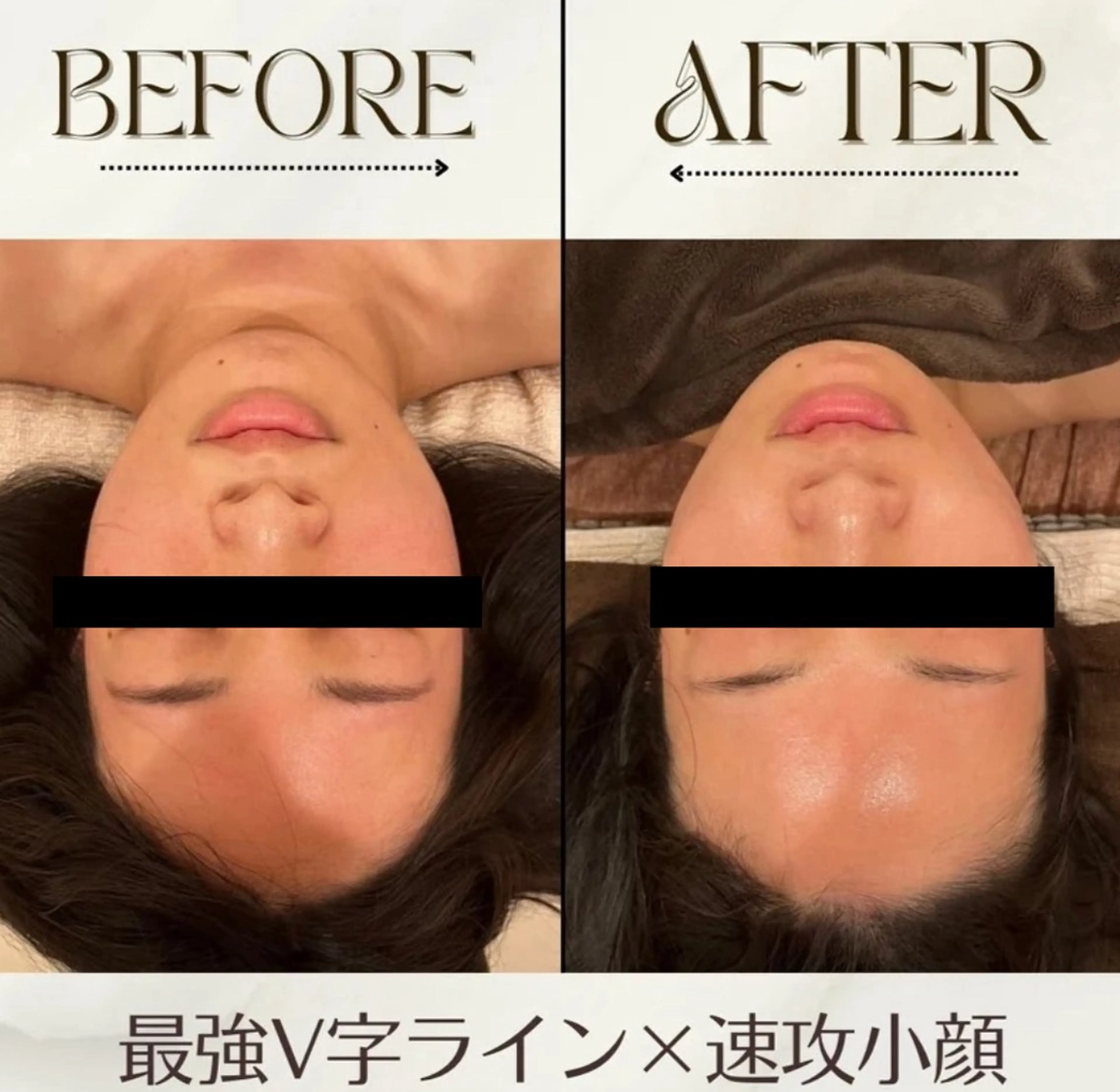最強V字ライン×速攻小顔フェイシャル40分✨の写真