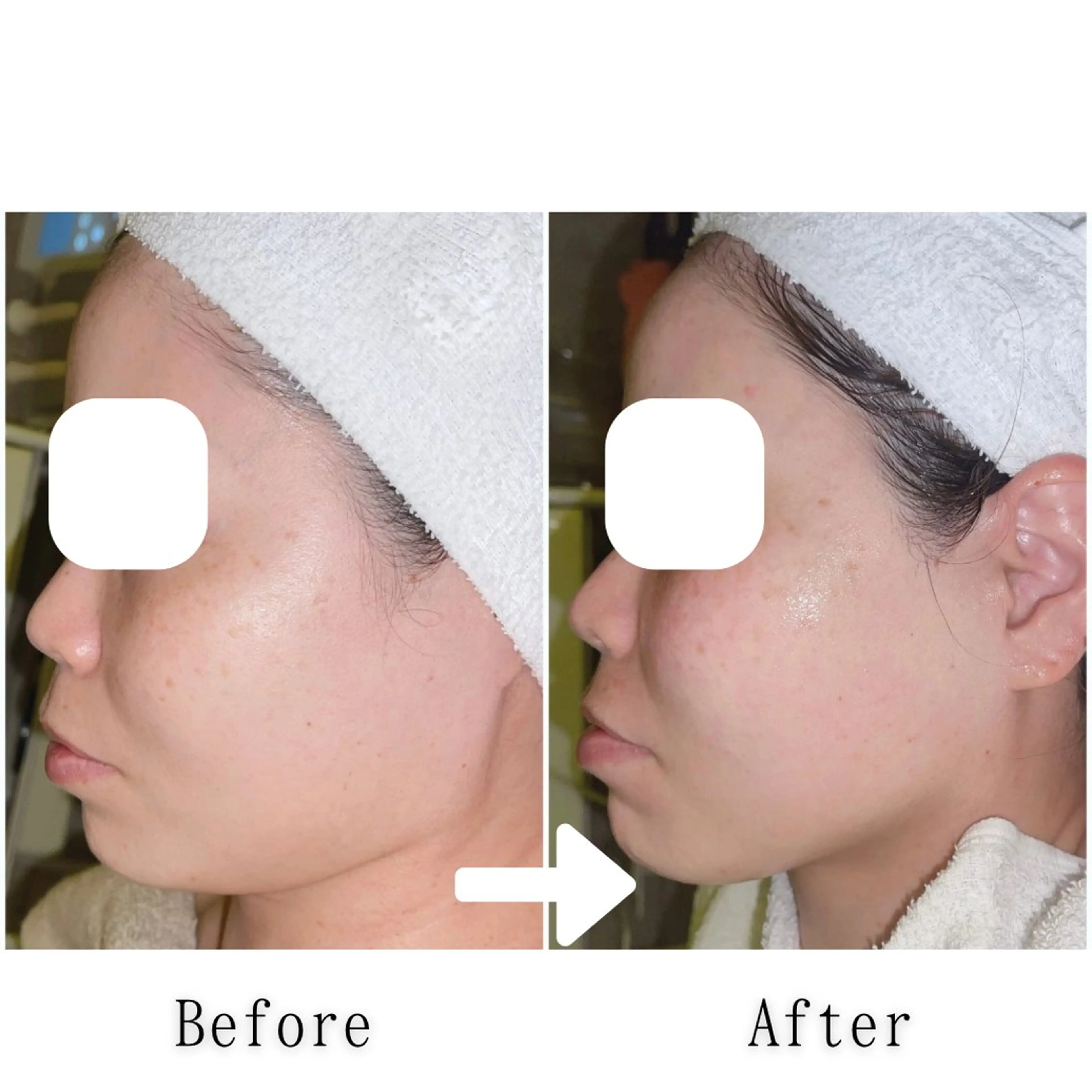 エステ SELF  BEAUTY gracia浦添店所属・gracia 浦添店のその他イメージ