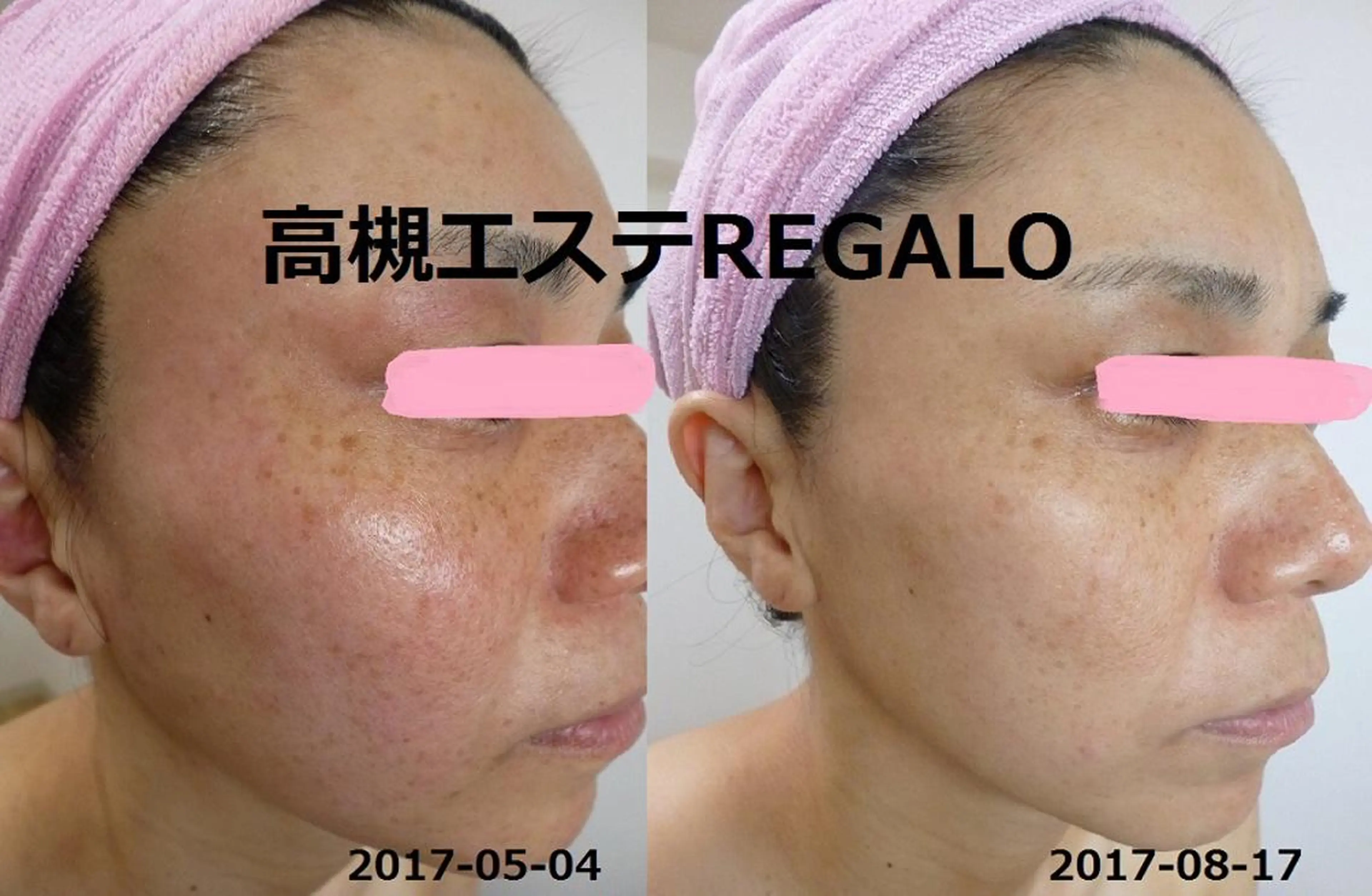 REGALO所属・矢野 さやかのエステ・リラクイメージ