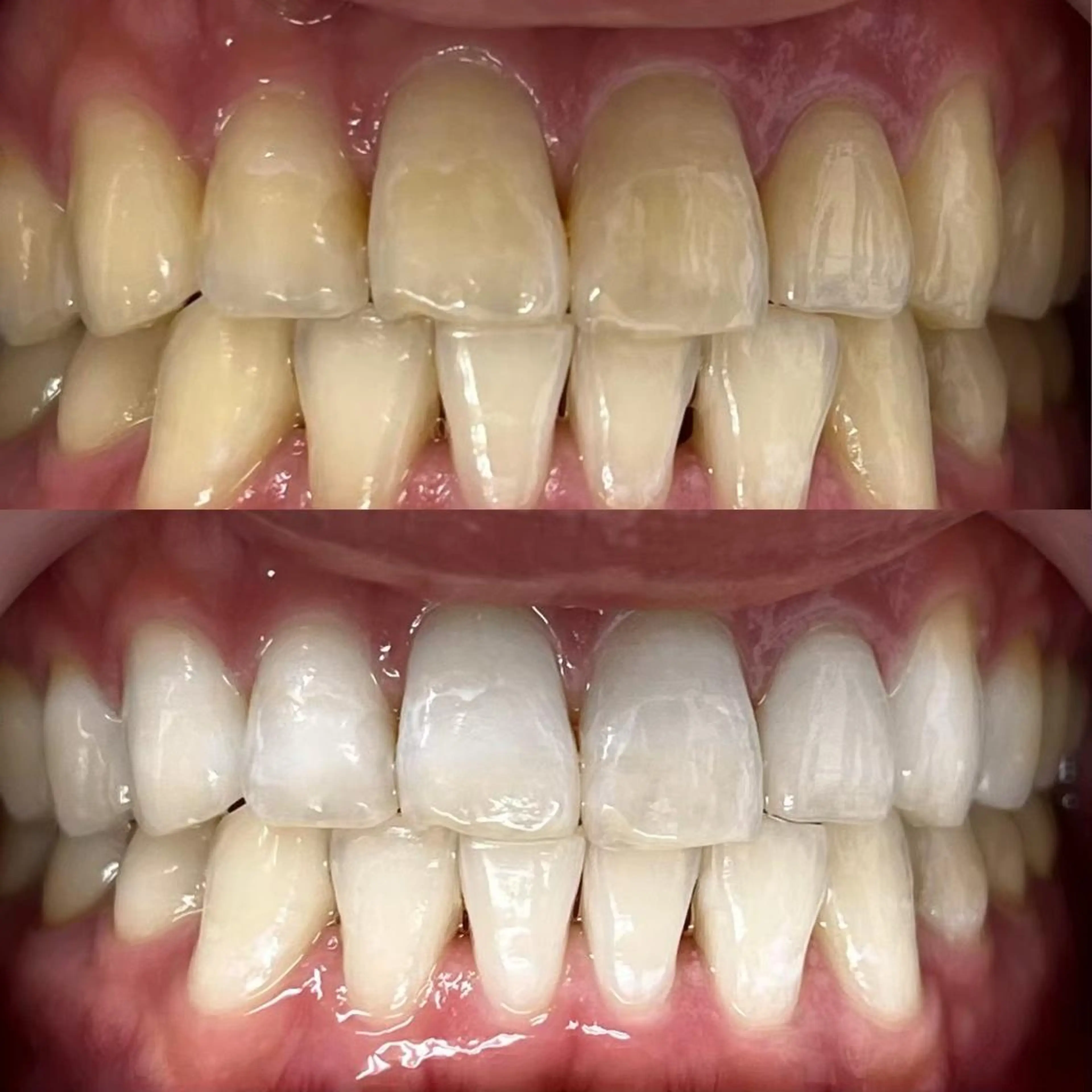 LBSホワイトニング 銀座店💎公式のその他イメージ