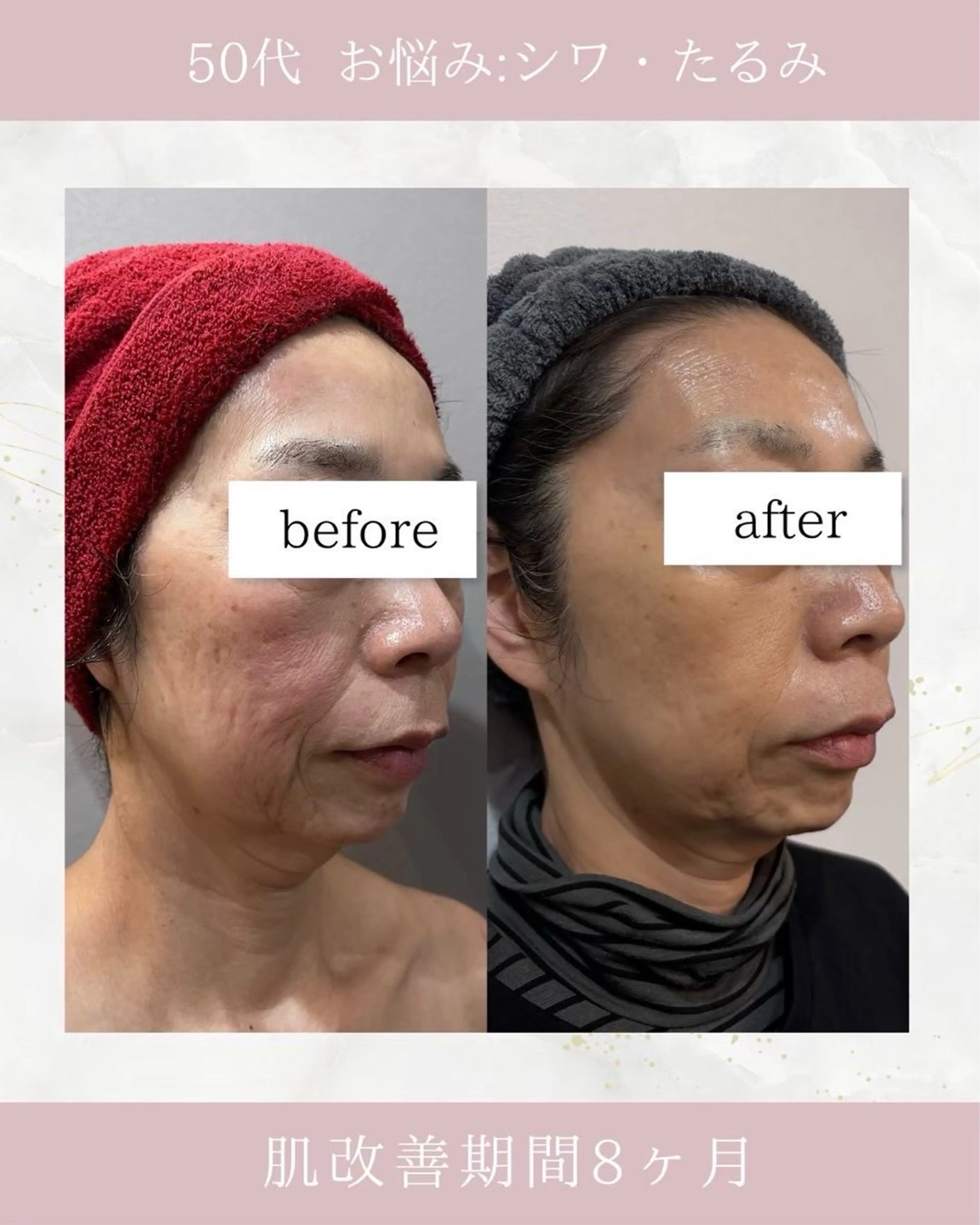 ARuru所属・ARuru 本店のエステ・リラクイメージ