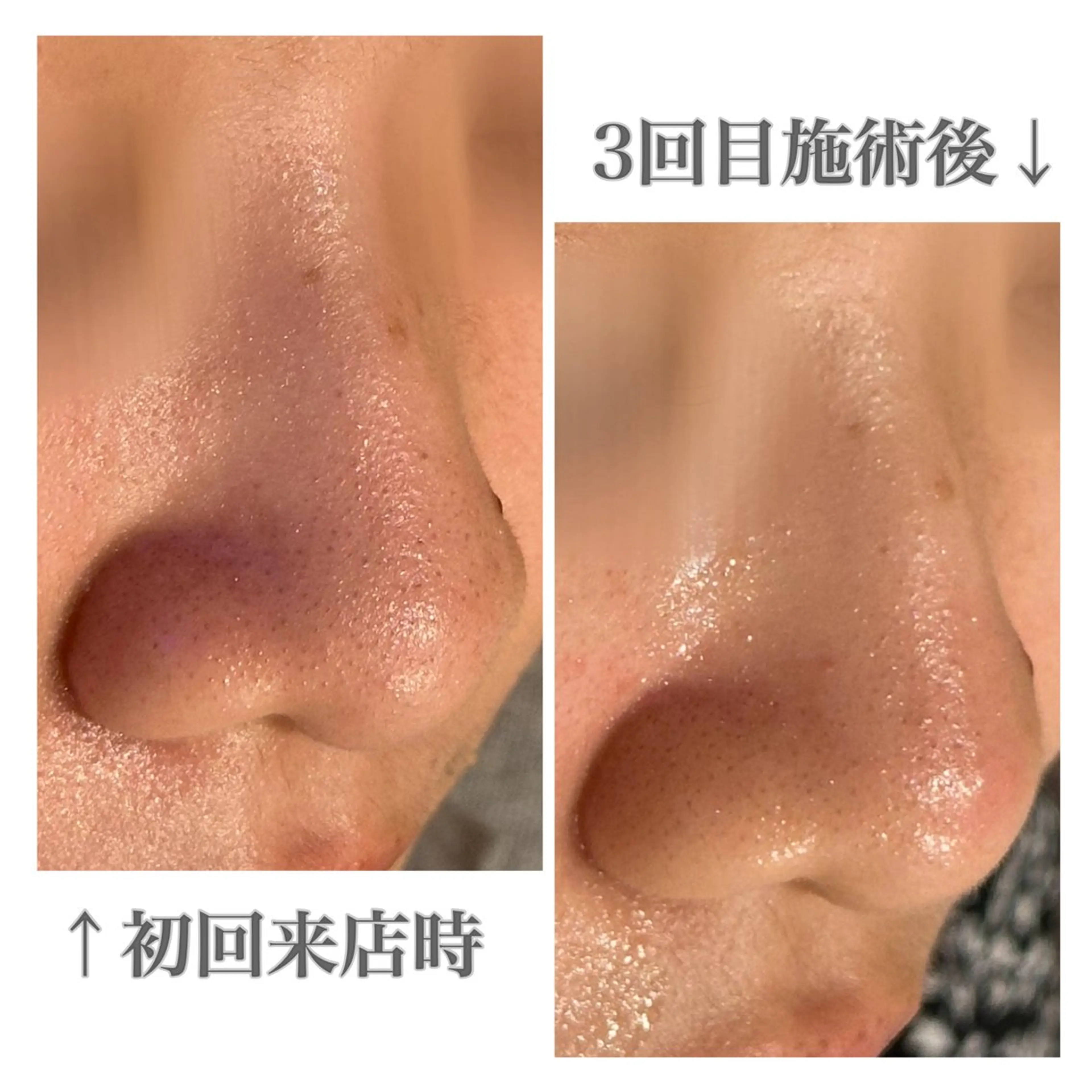 メンズ眉毛サロンラボ所属・メンズ眉毛サロンラボ 🫧 牧田 雪乃の眉毛・アイブロウイメージ