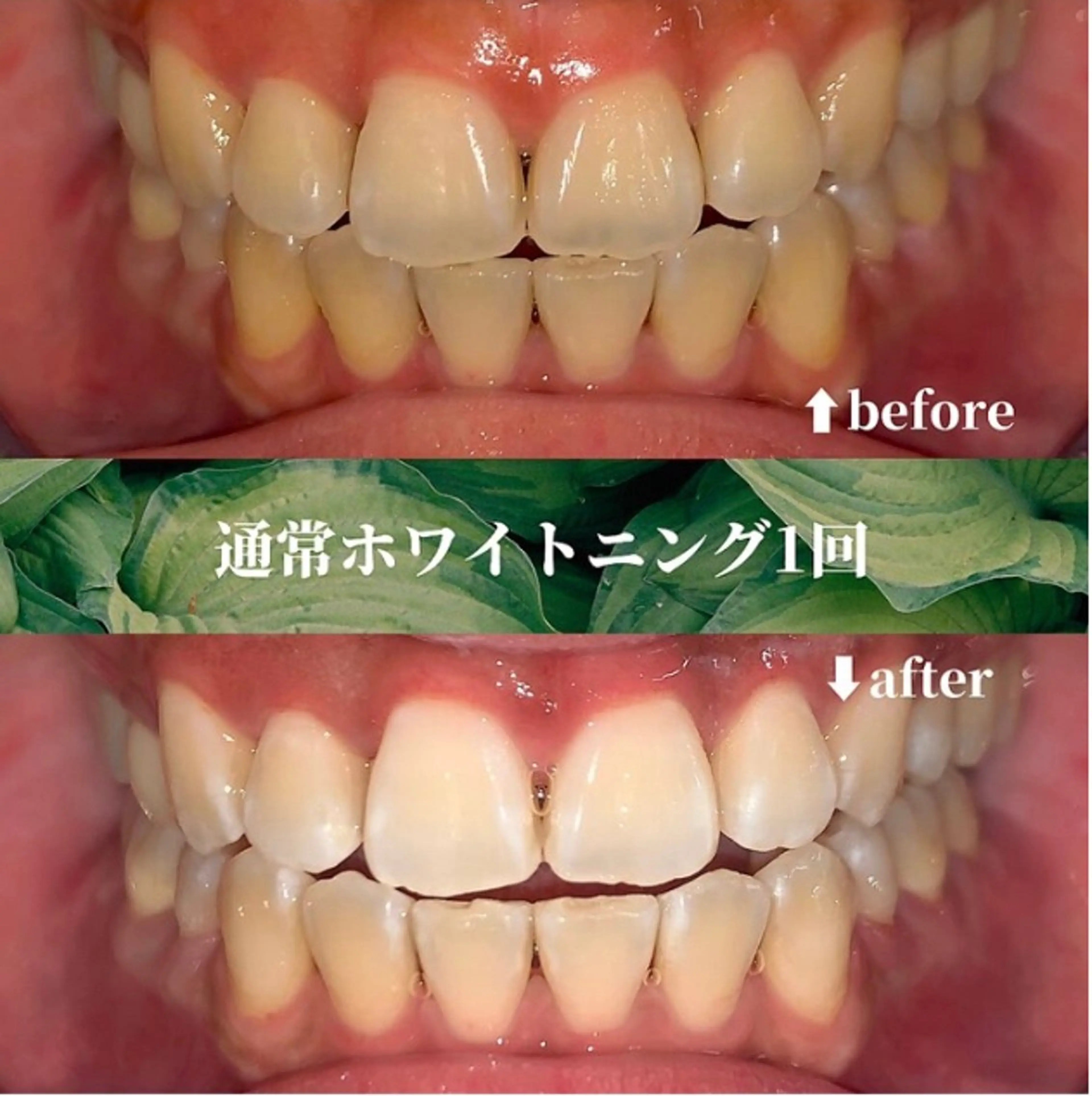 futaba ホワイトニング/天神のエステ・リラクイメージ