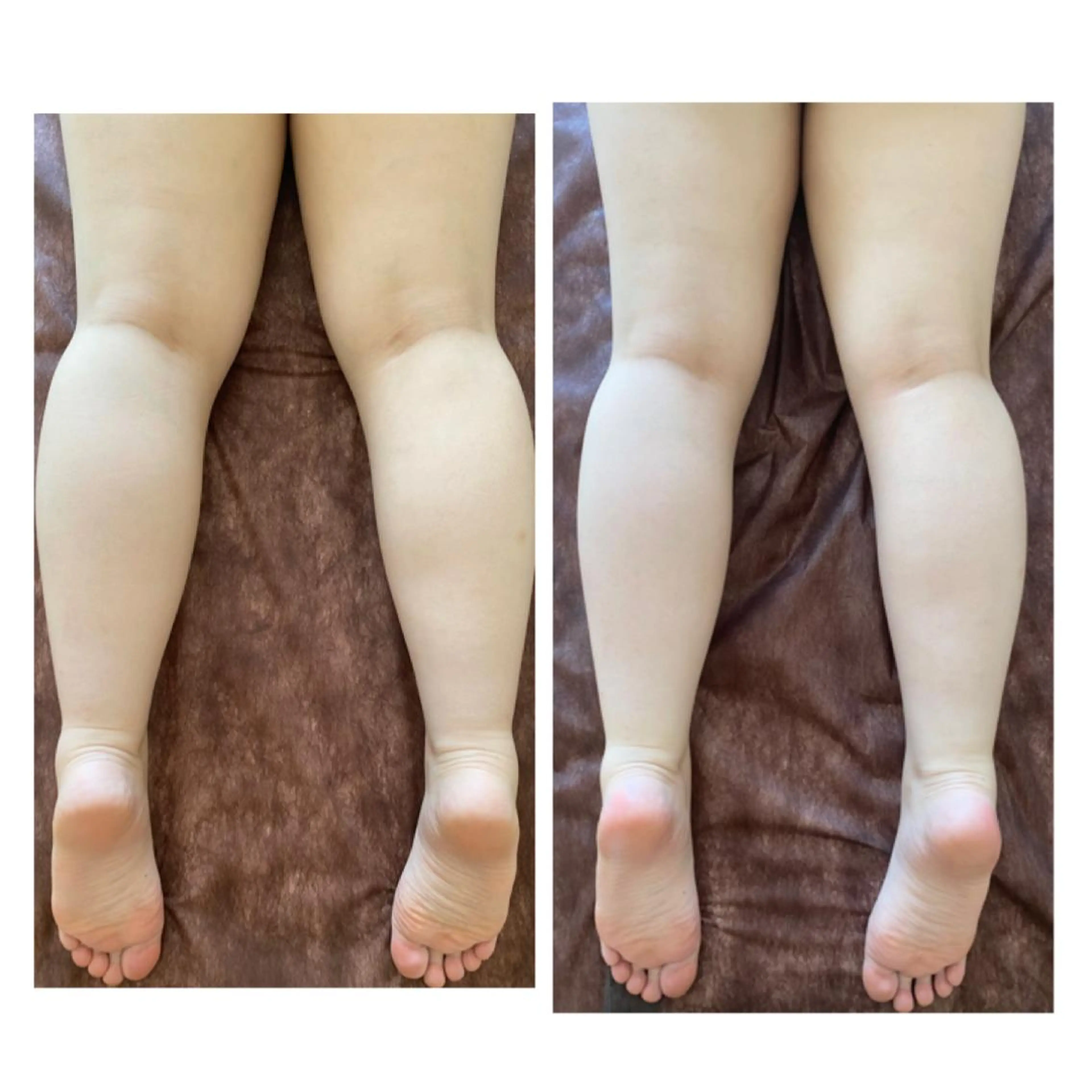 エステ Twinley (トゥインリー)のエステ・リラクイメージ