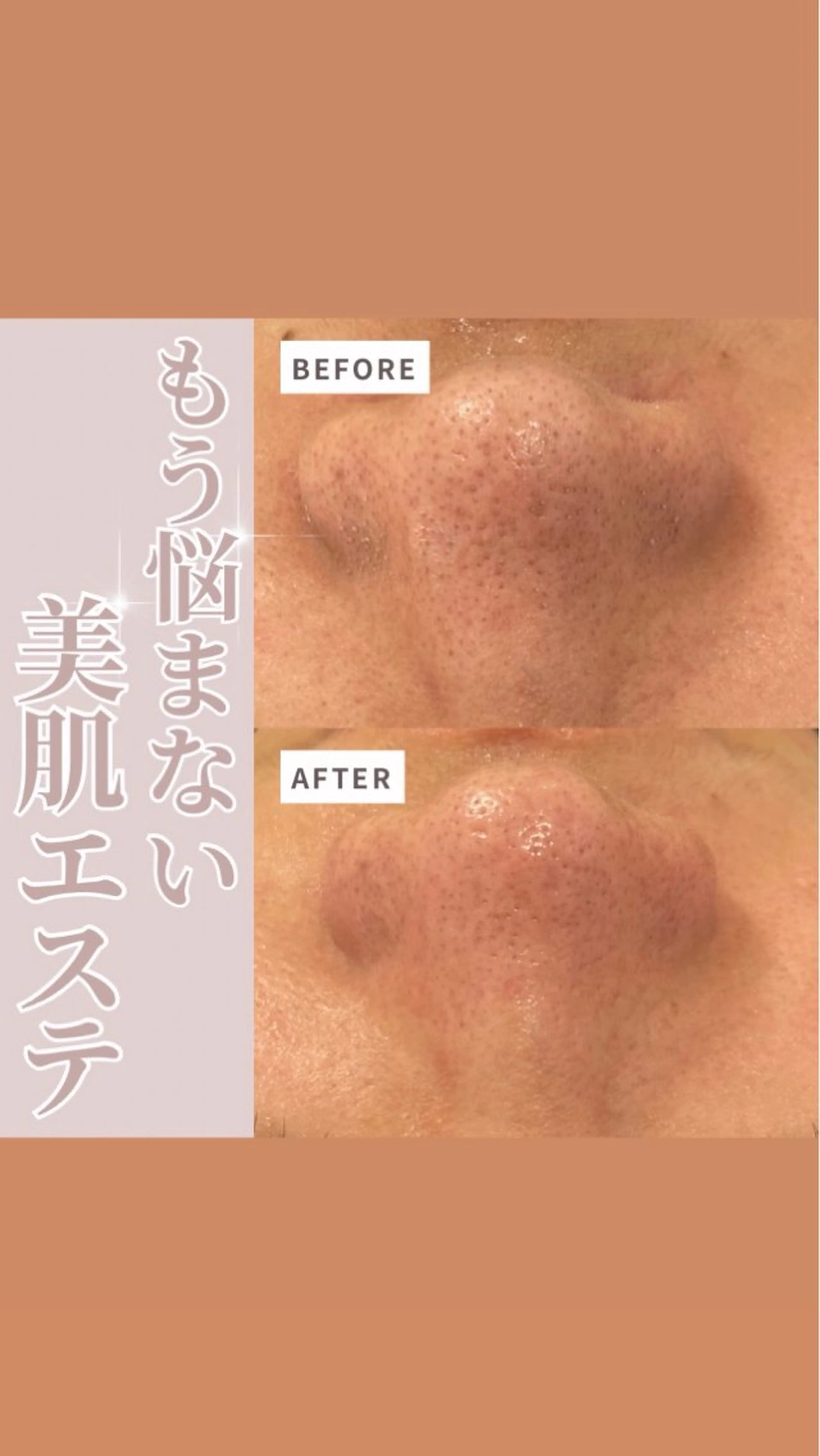 💚THE BALM 金子💚✨のエステ・リラクイメージ