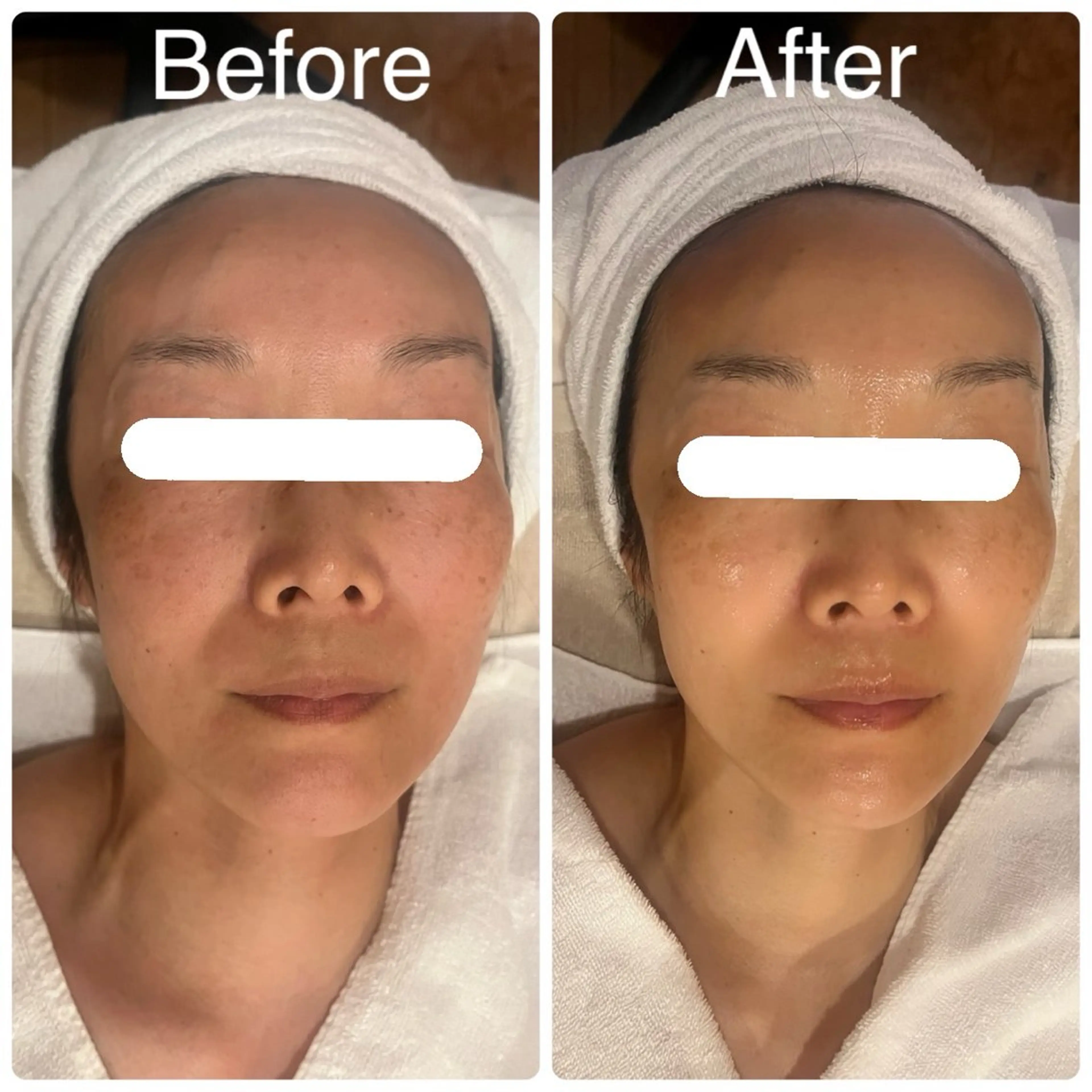 エステ リラク miel所属・毛穴＆ホワイトニング mielのエステ・リラクイメージ