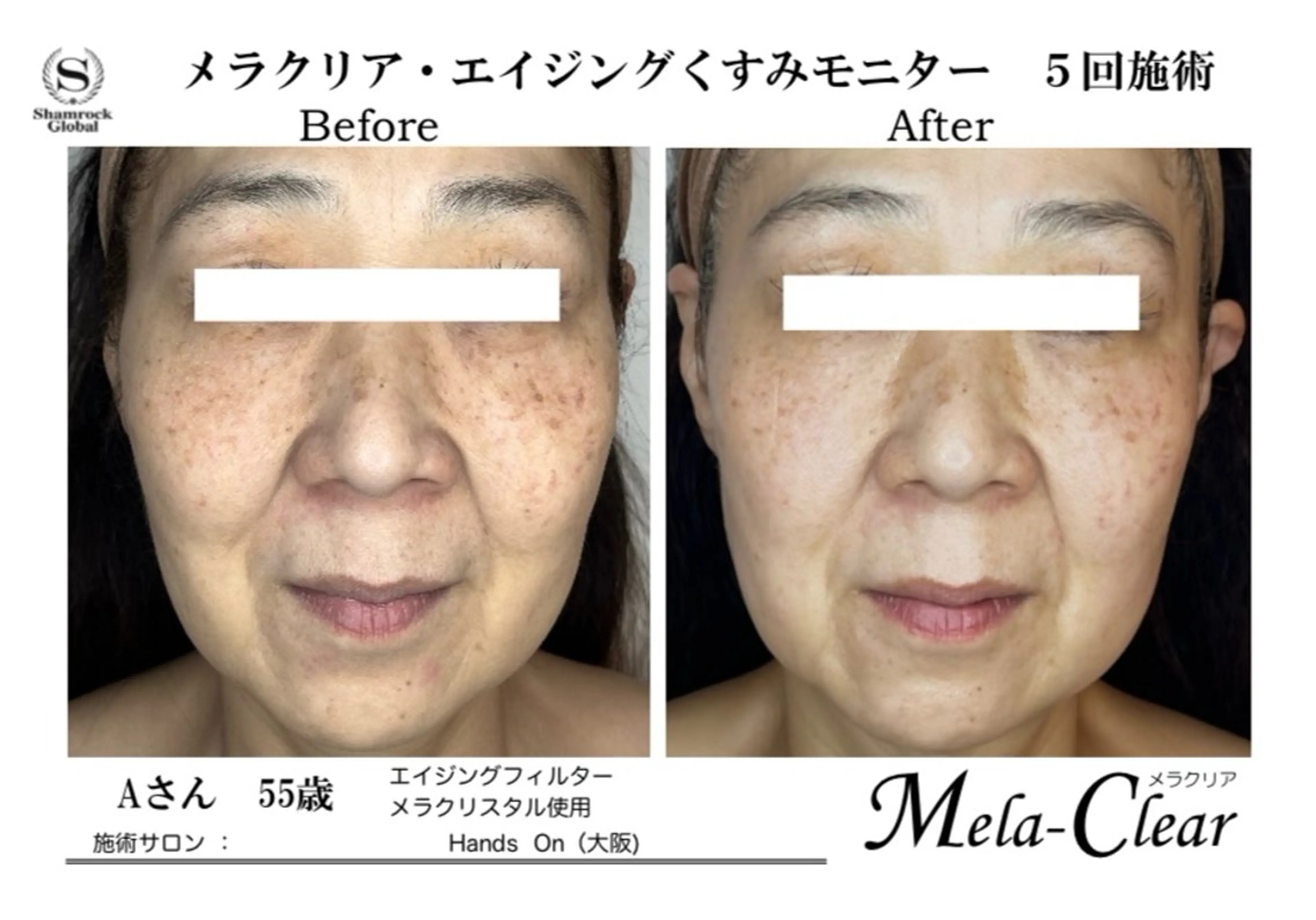 光フォト美容 エイジング、敏感肌のエステ・リラクイメージ