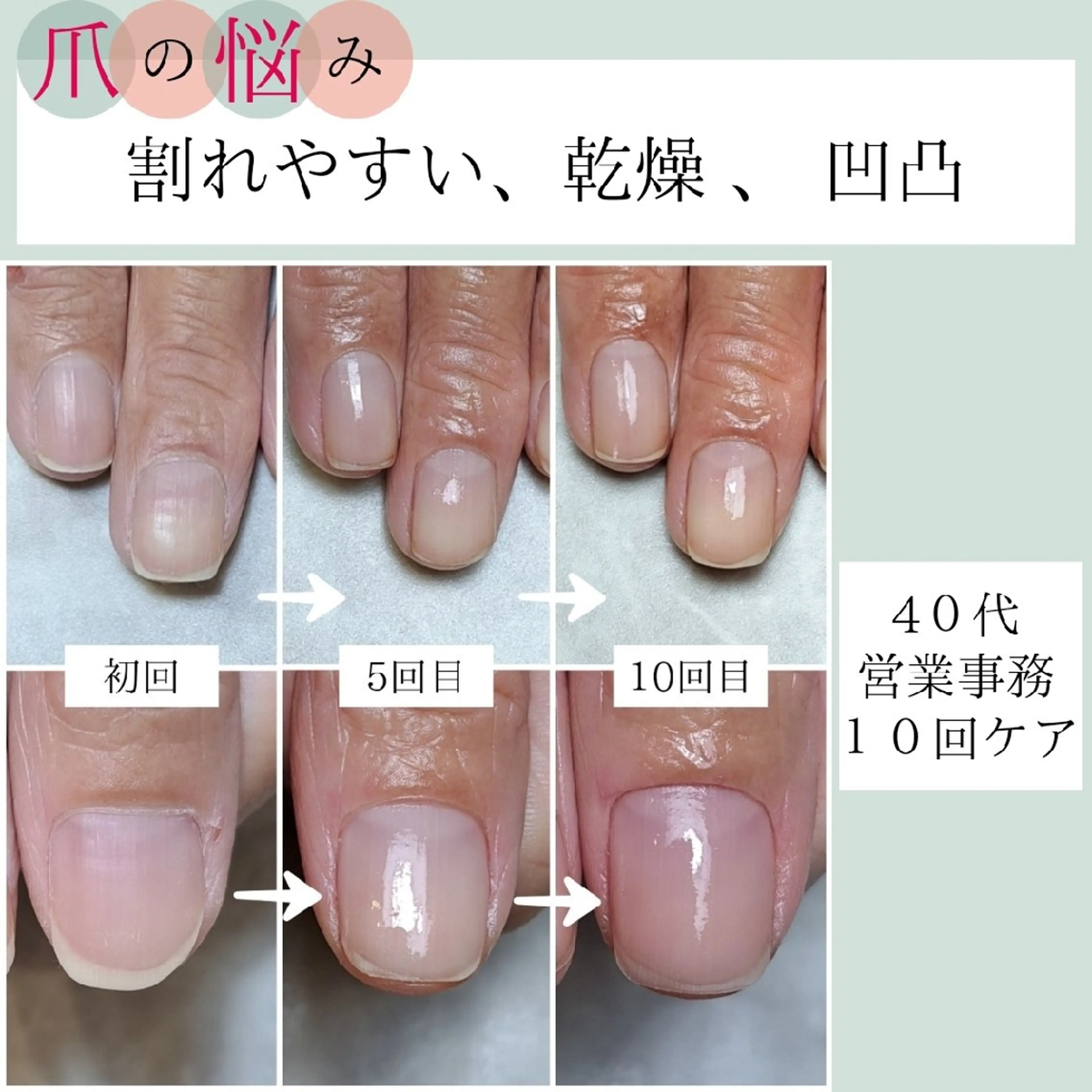 ネイル ハンドケア AKT NAIL所属・AKT Beauty エステヘッドスパのエステ・リラクイメージ