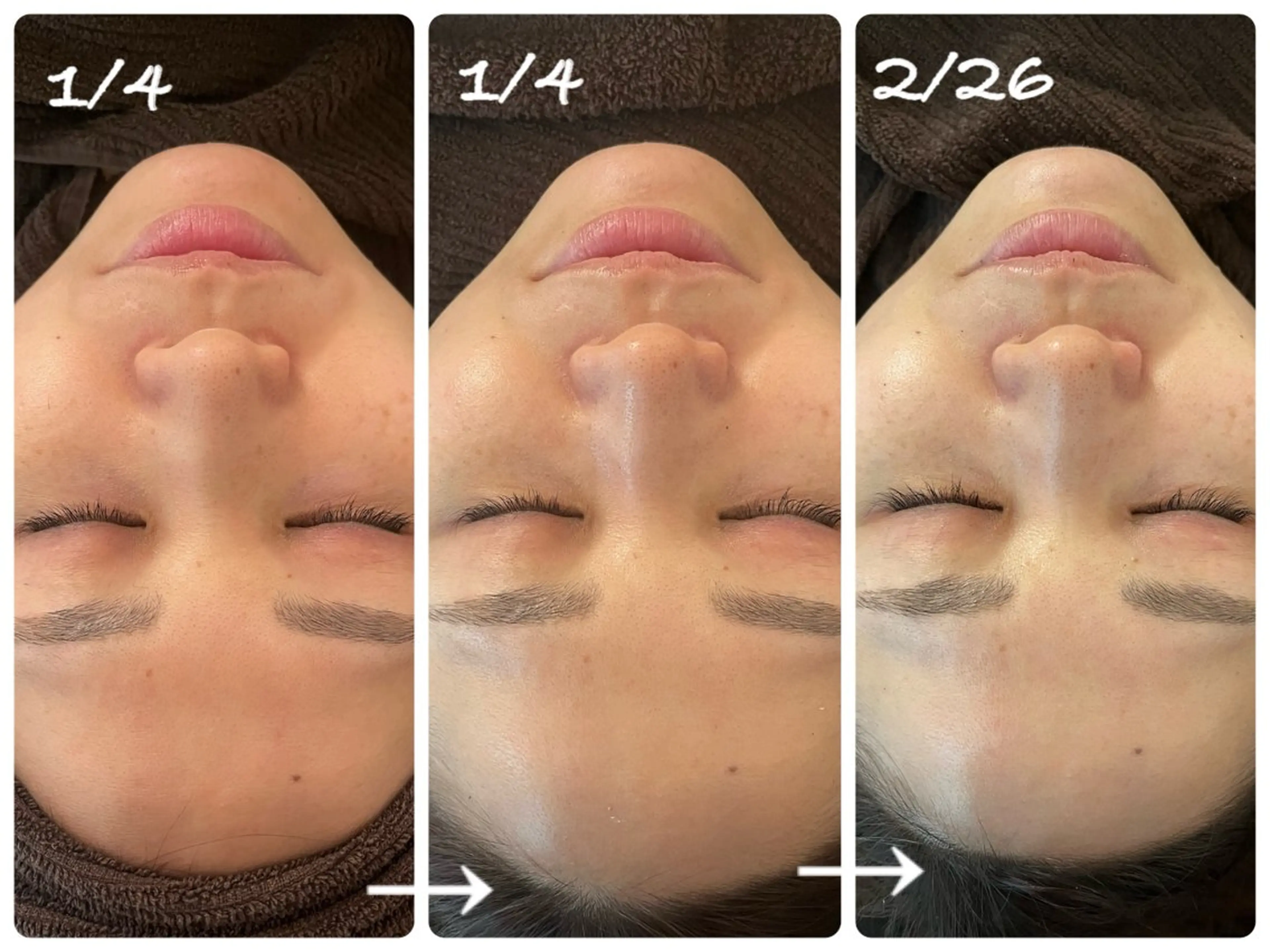 エステ luana beauty所属・kana ハーブピーリング🌿のエステ・リラクイメージ