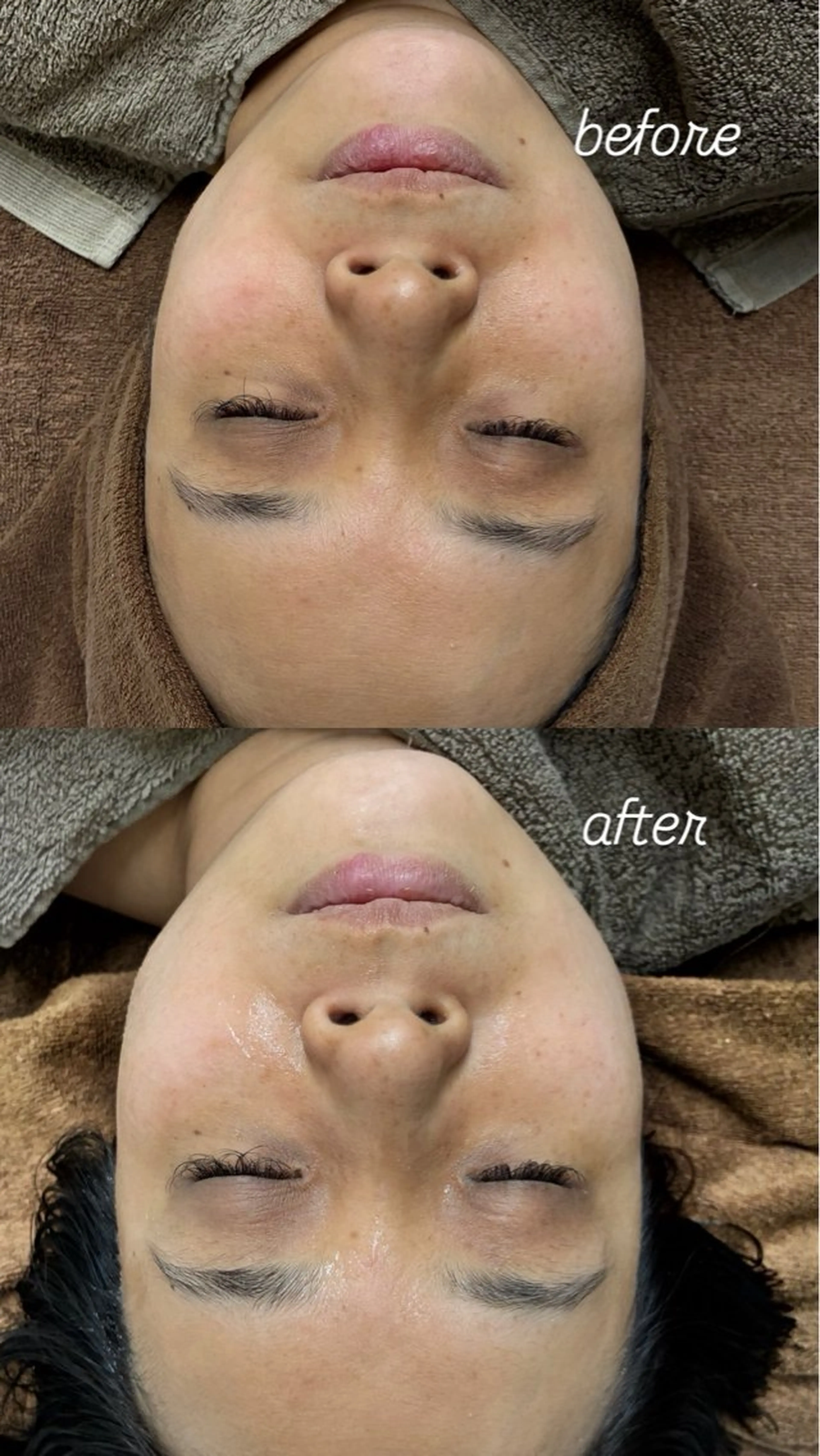 エステ smile nail スマイルネイルのその他イメージ