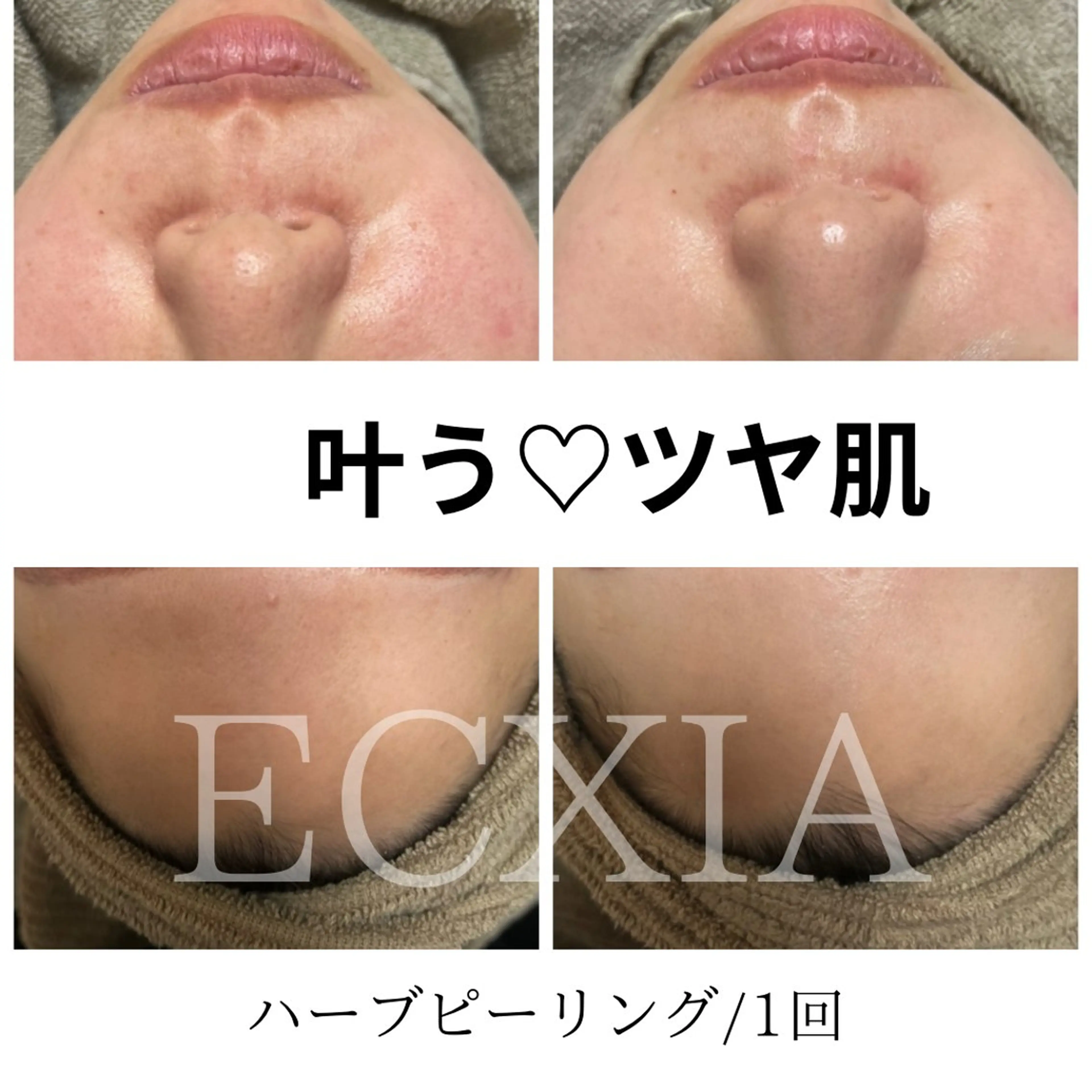 エステ ECXIA 【エクシア】のエステ・リラクイメージ