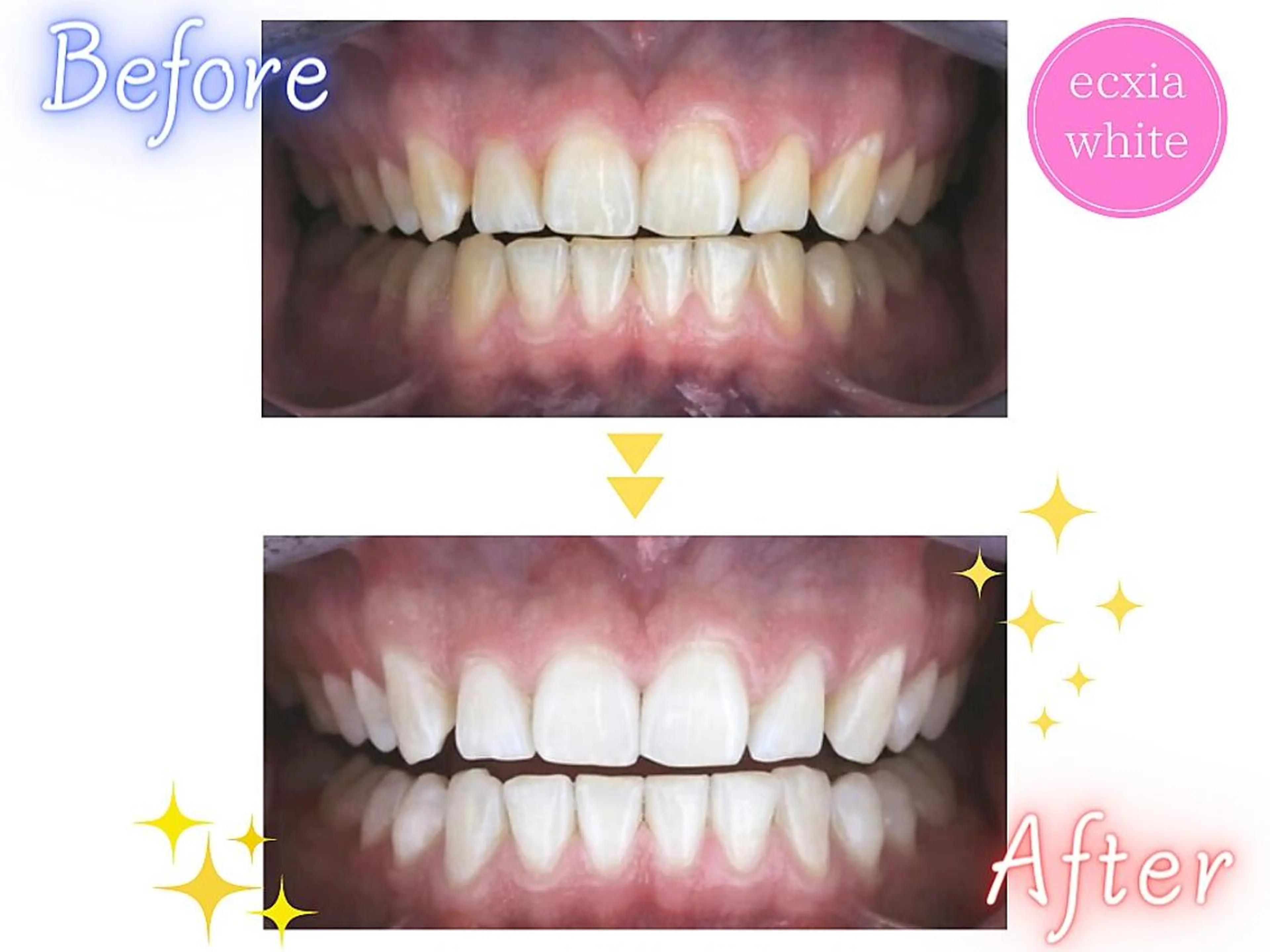 セルフホワイトニング エクシア新宿御苑店のその他イメージ