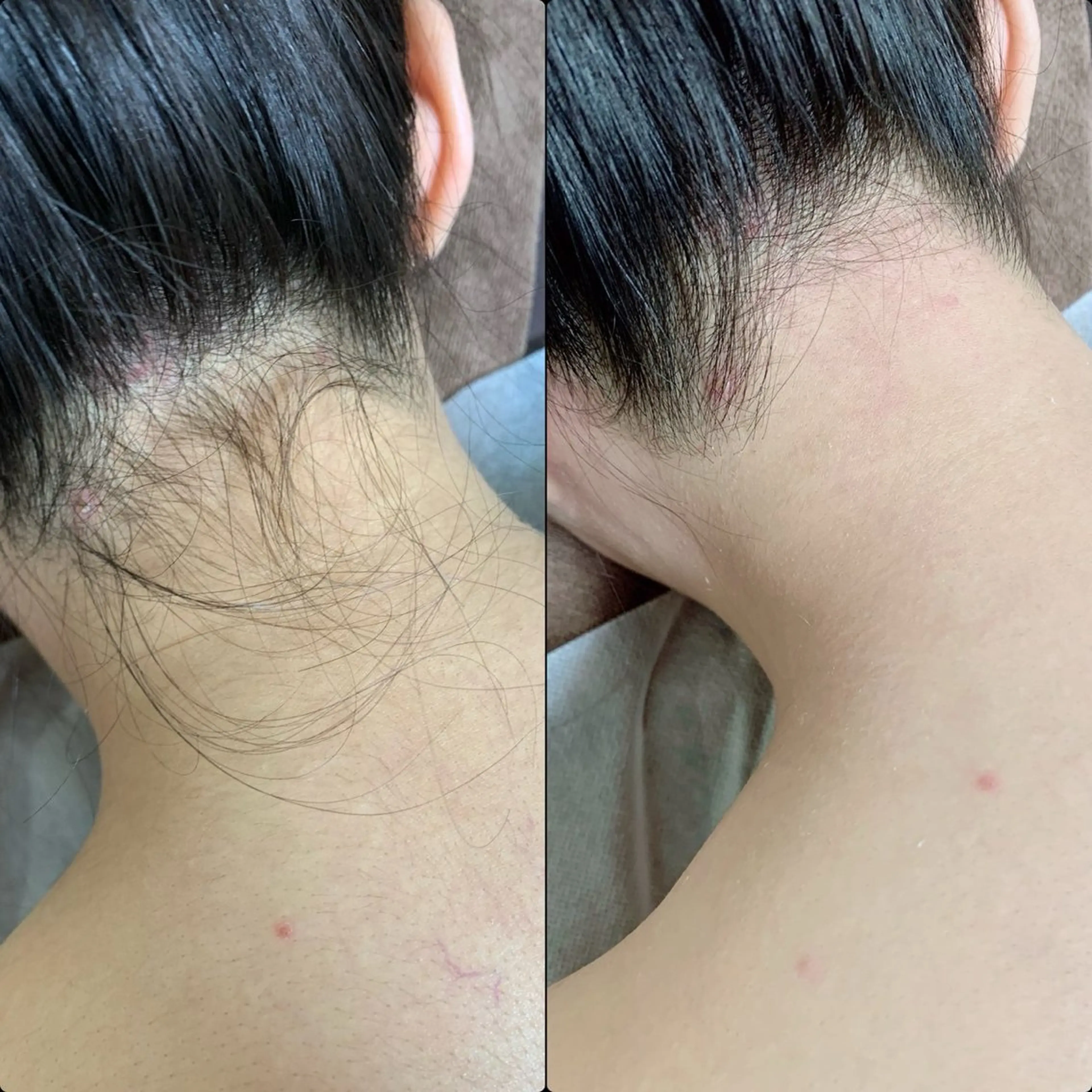 六本木脱毛andS さおりのエステ・リラクイメージ