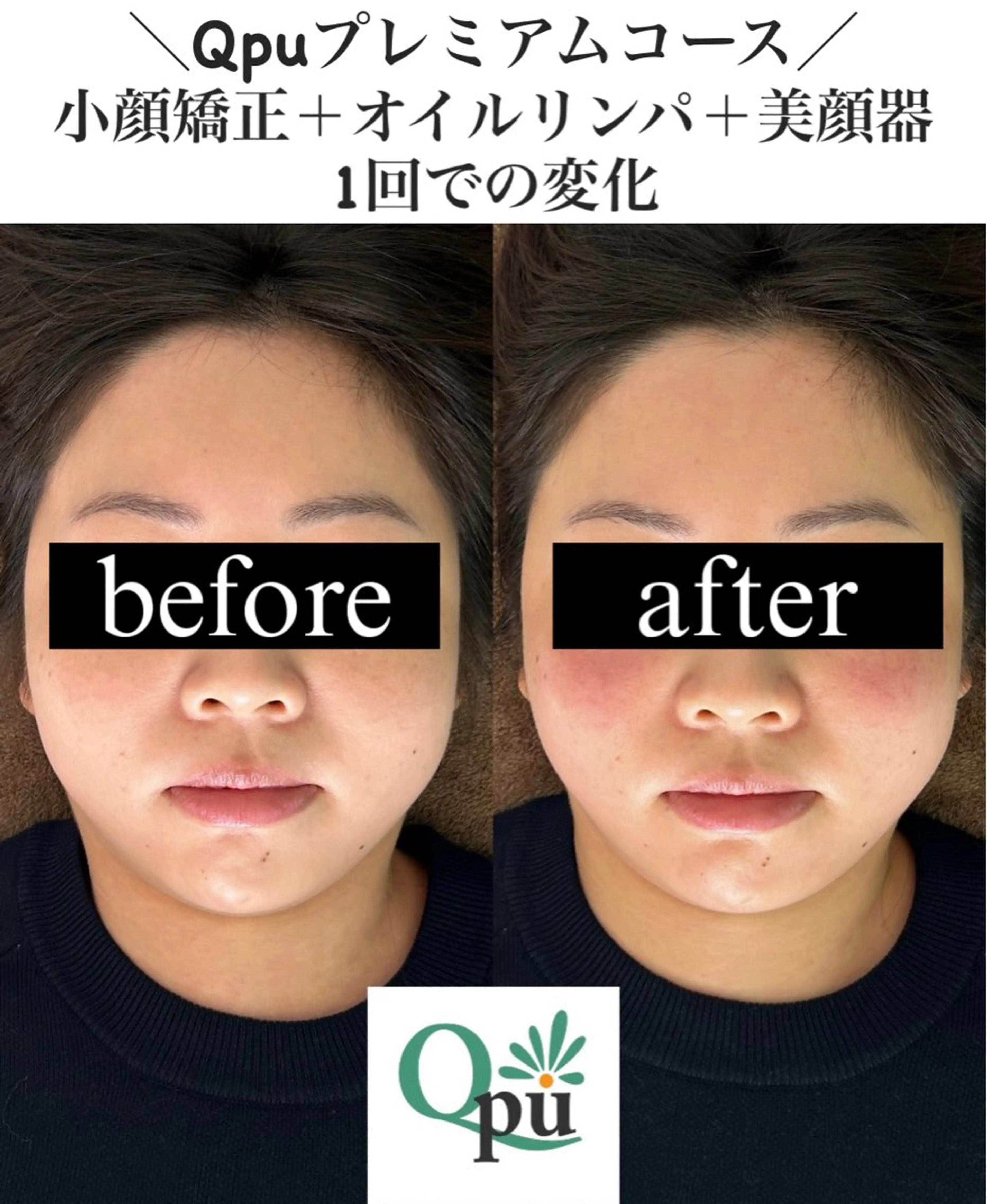 Qpu(キュープ)下北沢店所属・鮎川 さゆりのエステ・リラクイメージ