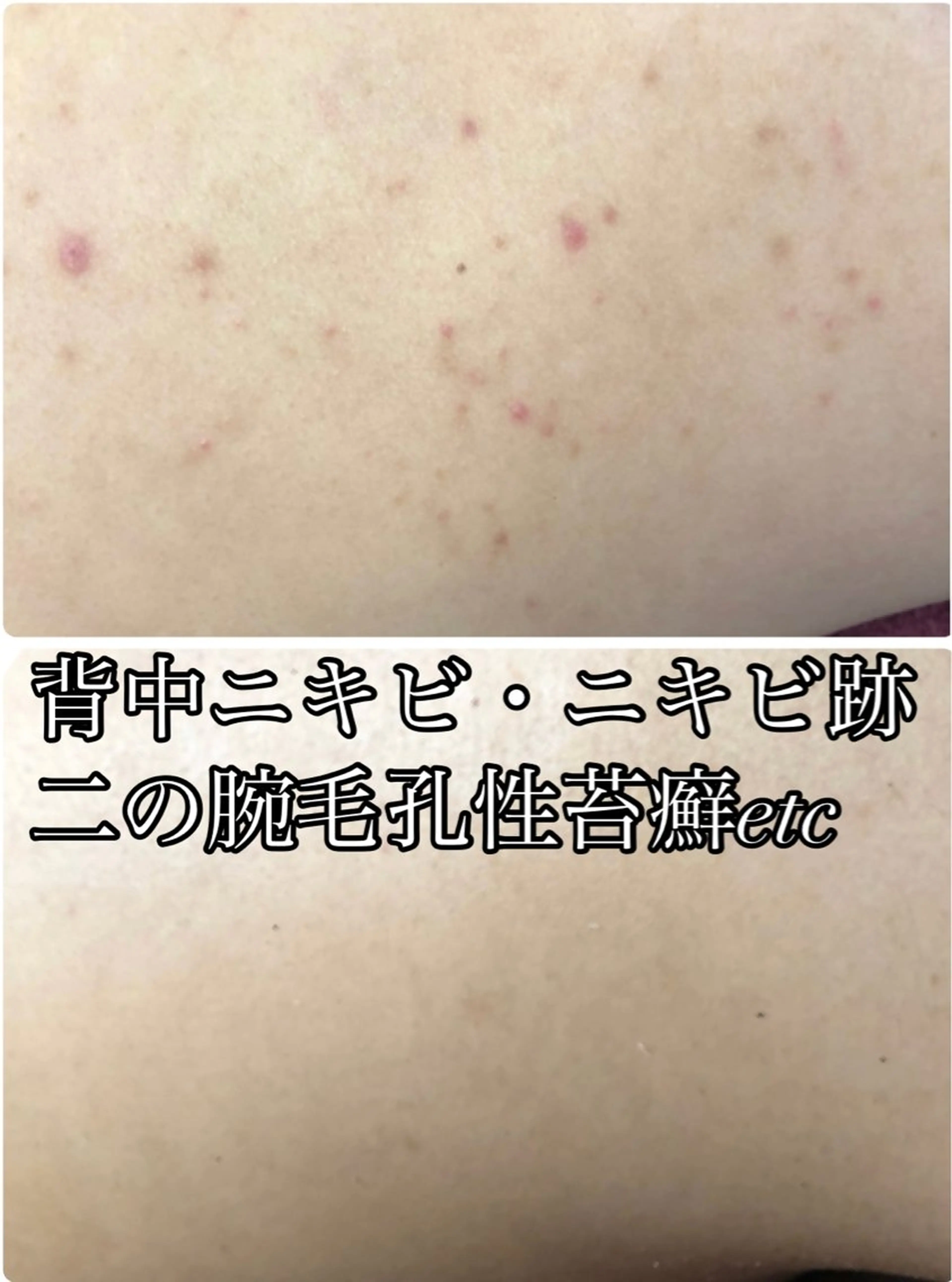 エステ LILIANA所属・LILIANA ☆YURIのエステ・リラクイメージ