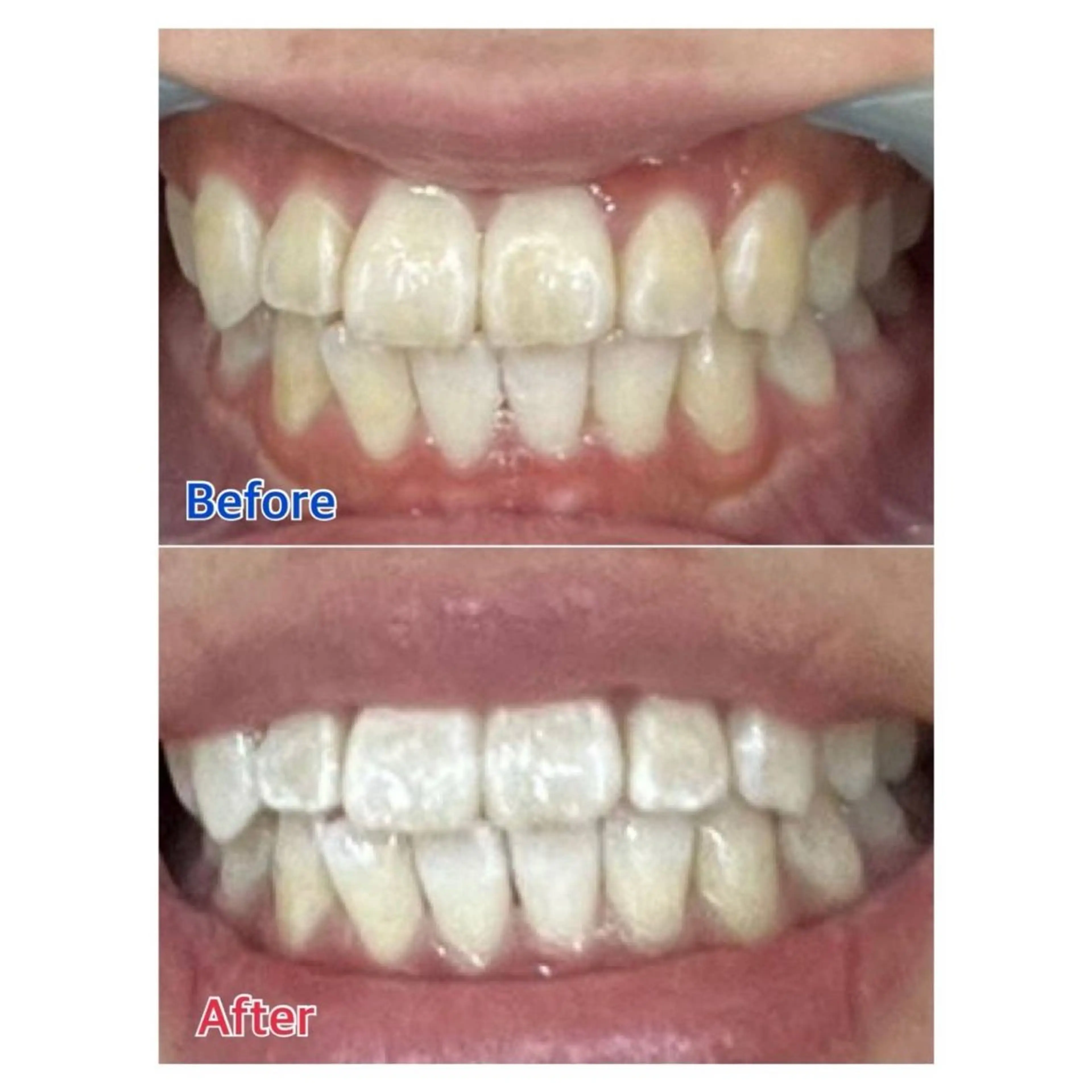 MBEAUTYSALON 千葉店・京成大久保所属・Melty 輝のその他イメージ