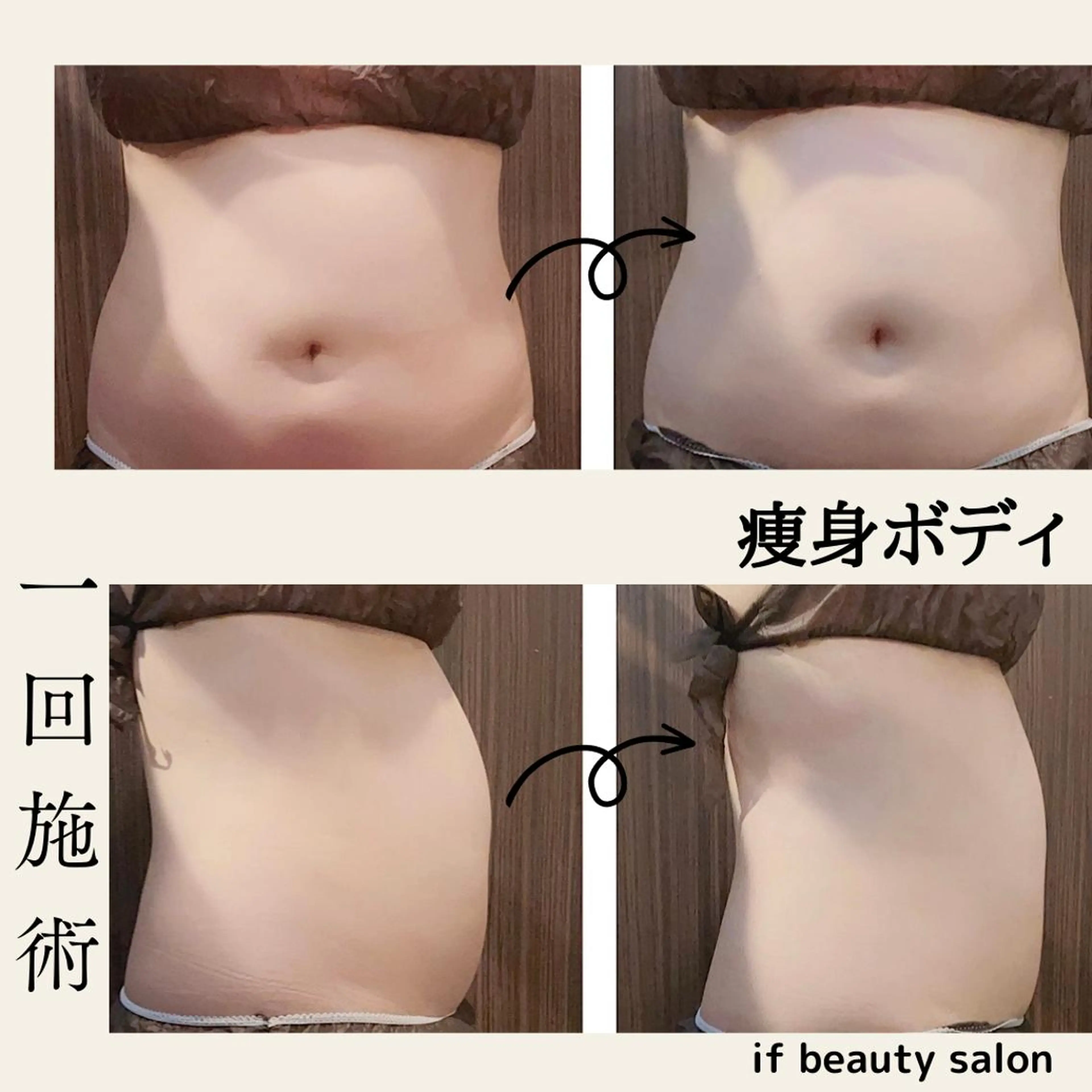 痩身・フェイシャル/if  byOrabriller所属・if byOrab riller【ｲﾌ】のその他イメージ