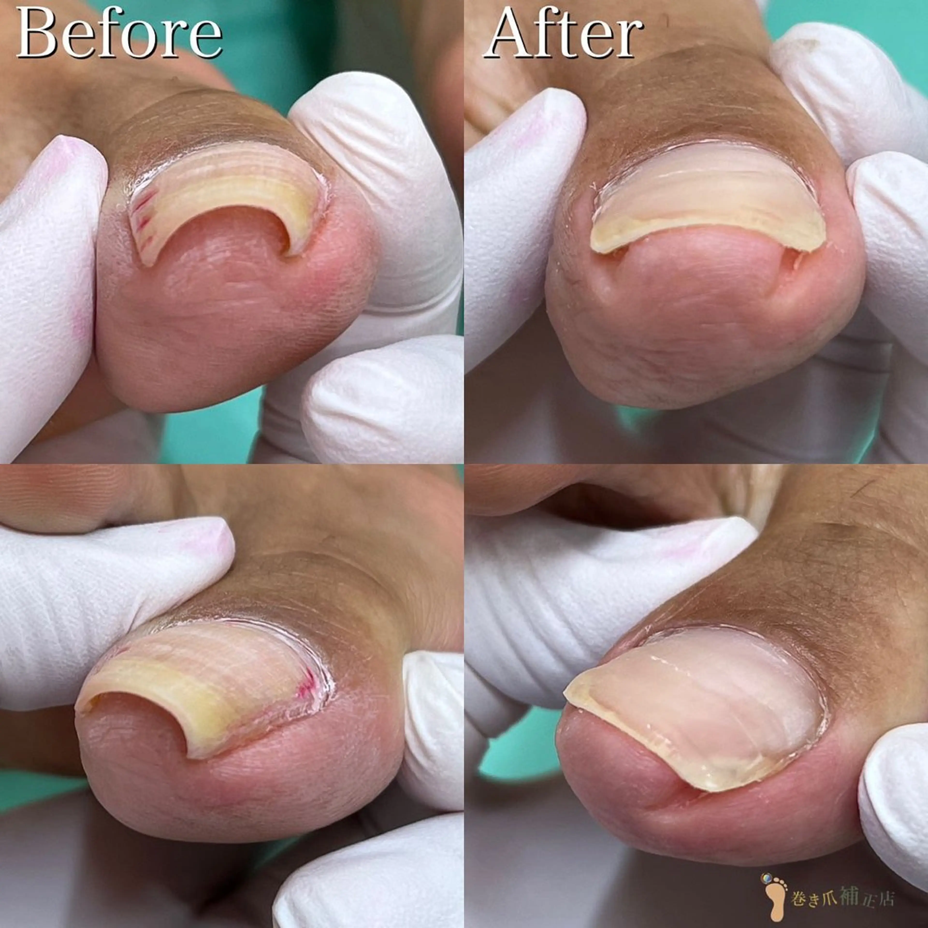 ネイル 大宮巻き爪補正店所属・大宮 巻き爪補正店のエステ・リラクイメージ